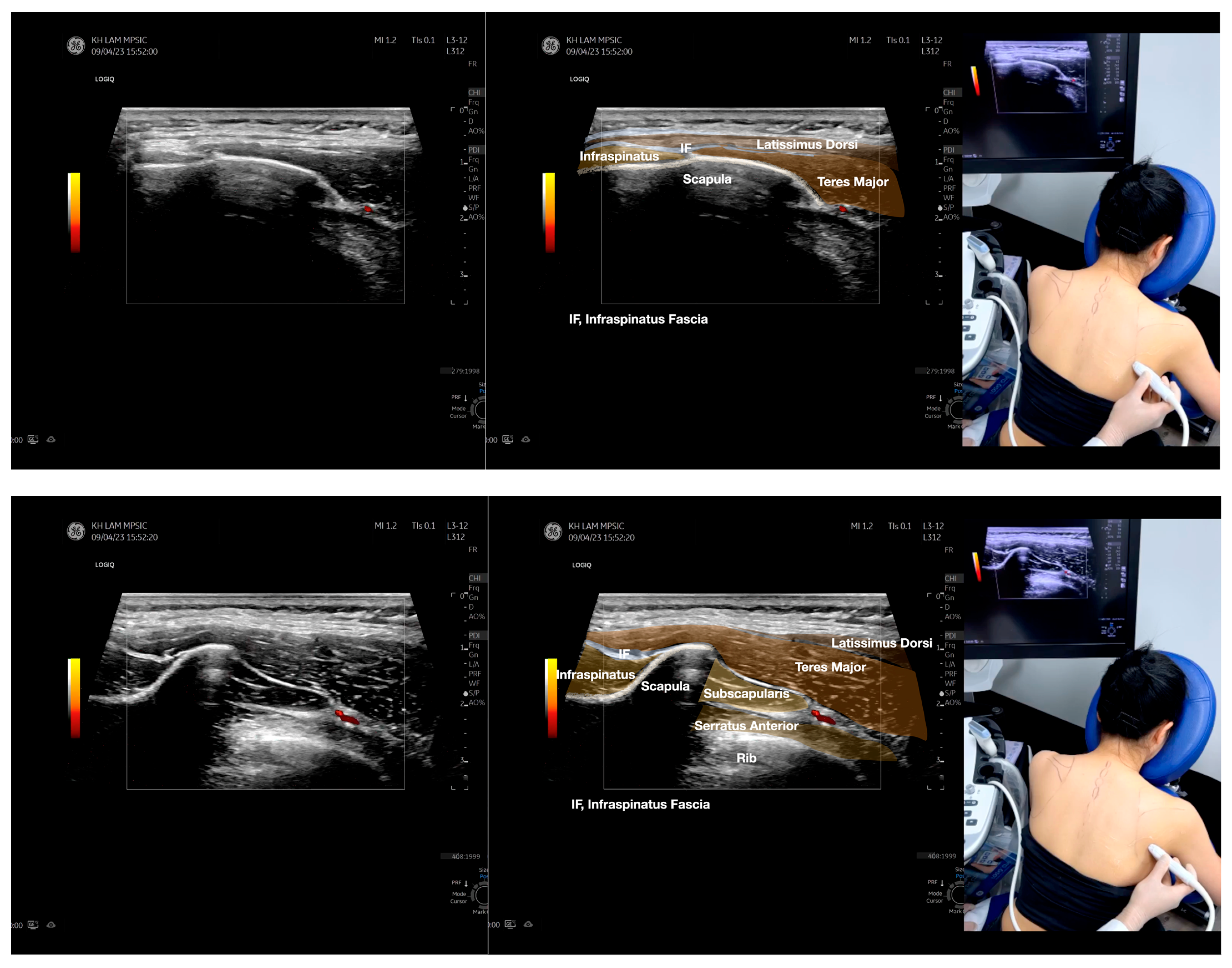 Diagnostics 13 02601 g003b Diagnostics 13 02601 g003b