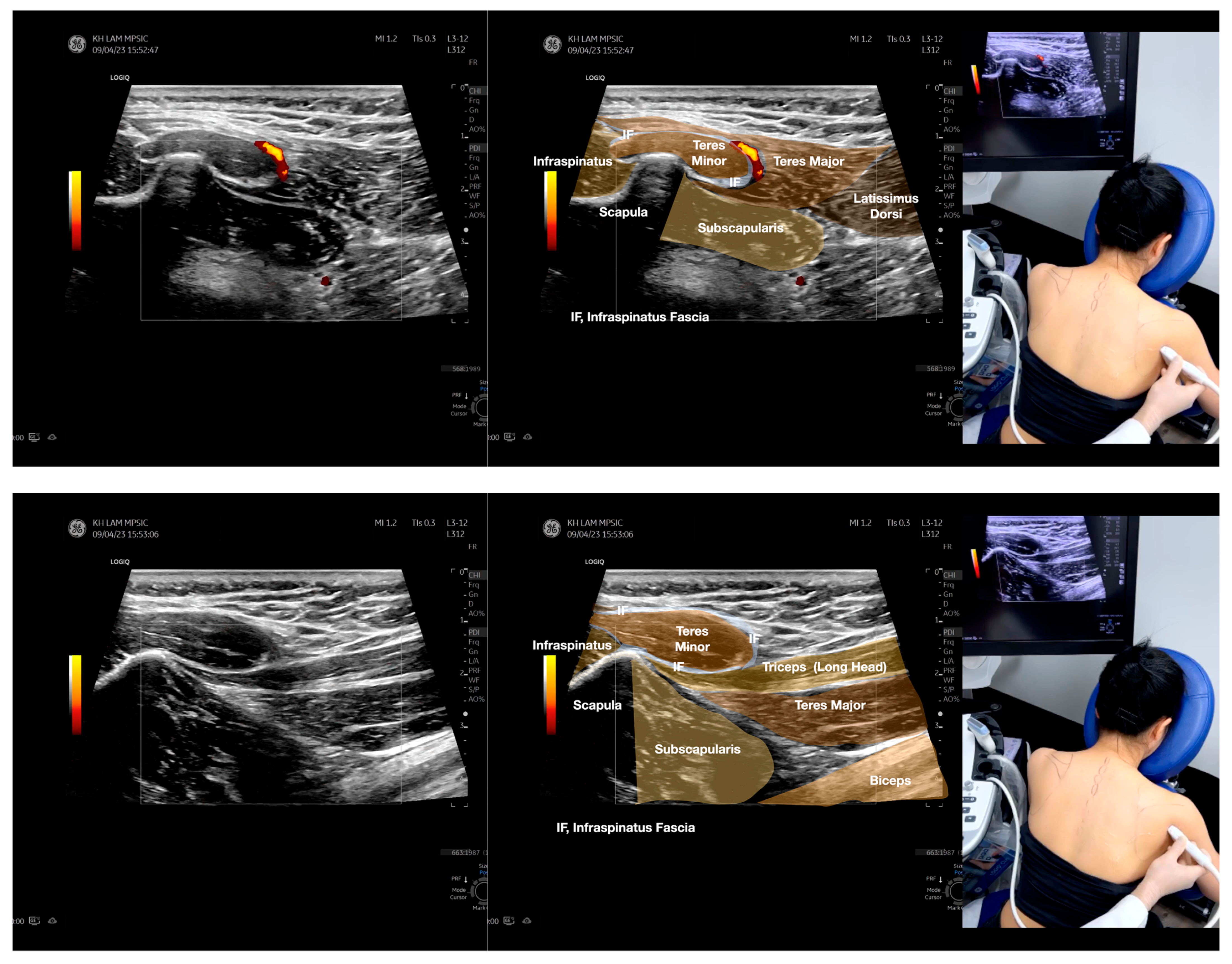 Diagnostics 13 02601 g003c Diagnostics 13 02601 g003c