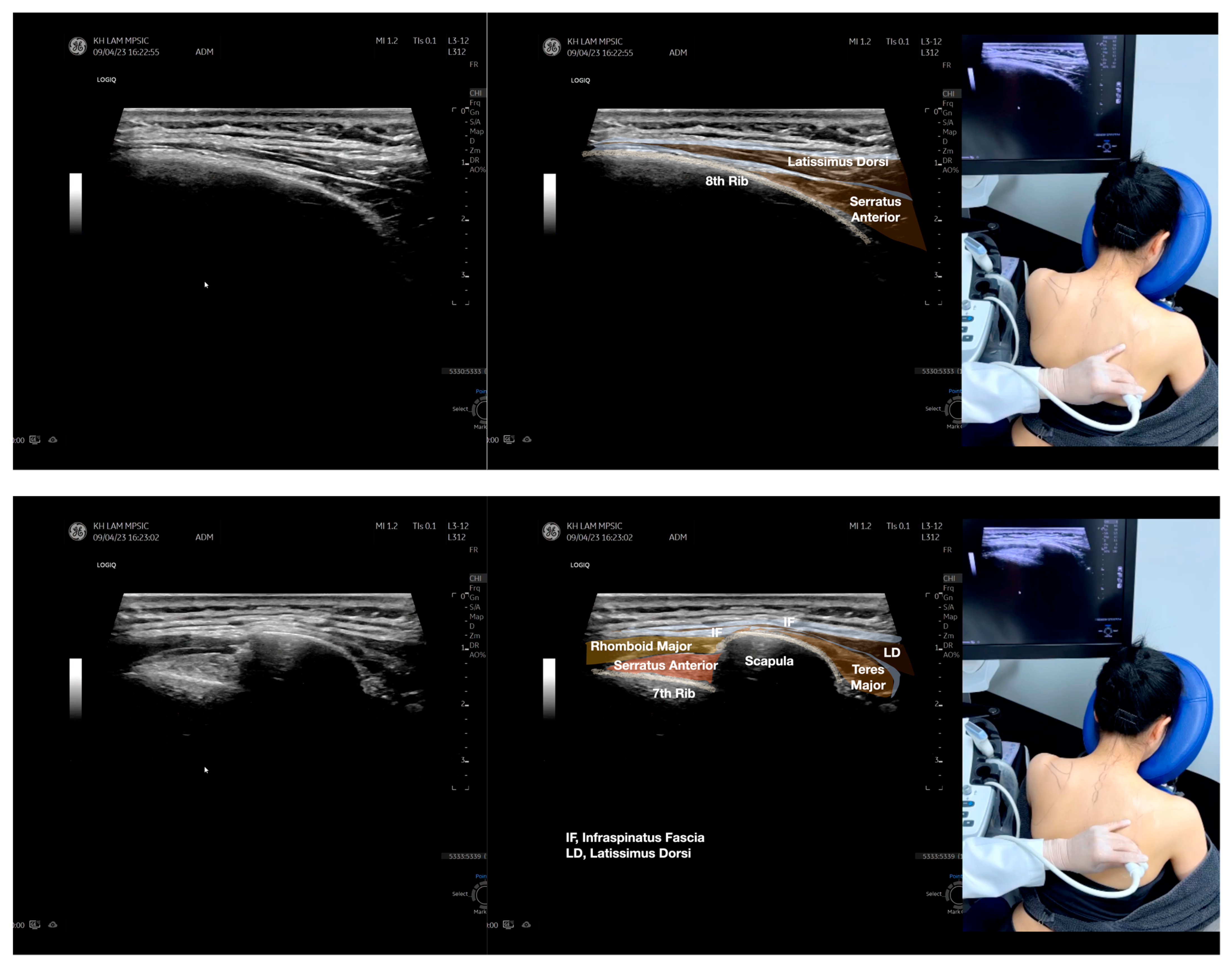 Diagnostics 13 02601 g004a Diagnostics 13 02601 g004a
