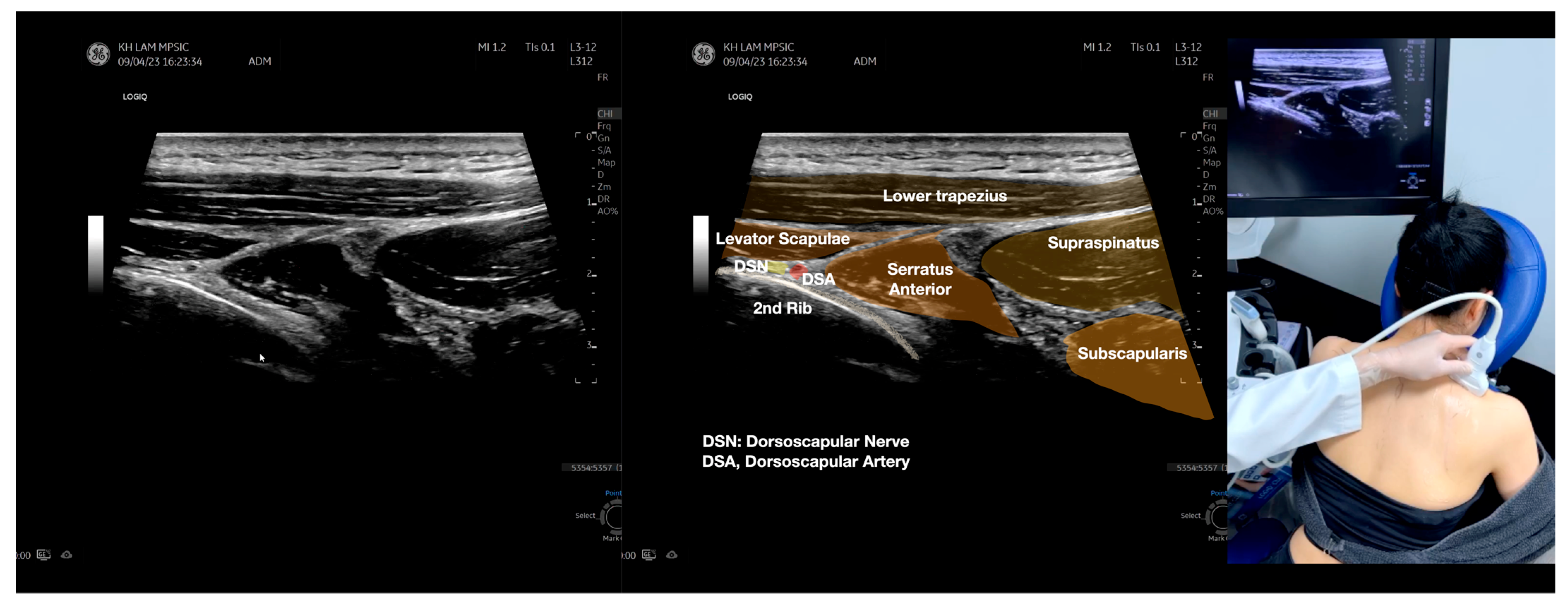 Diagnostics 13 02601 g004d Diagnostics 13 02601 g004d