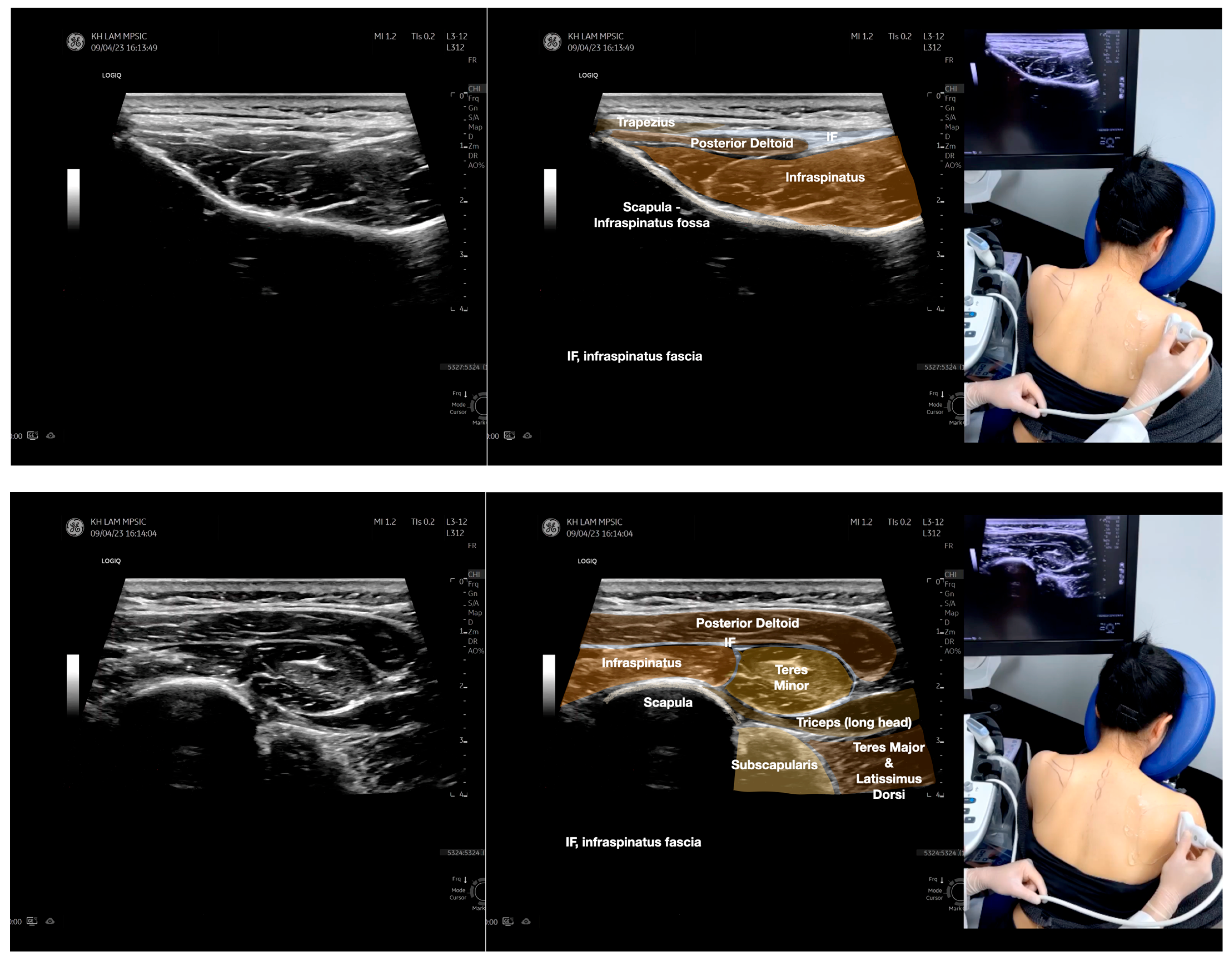 Diagnostics 13 02601 g005b Diagnostics 13 02601 g005b