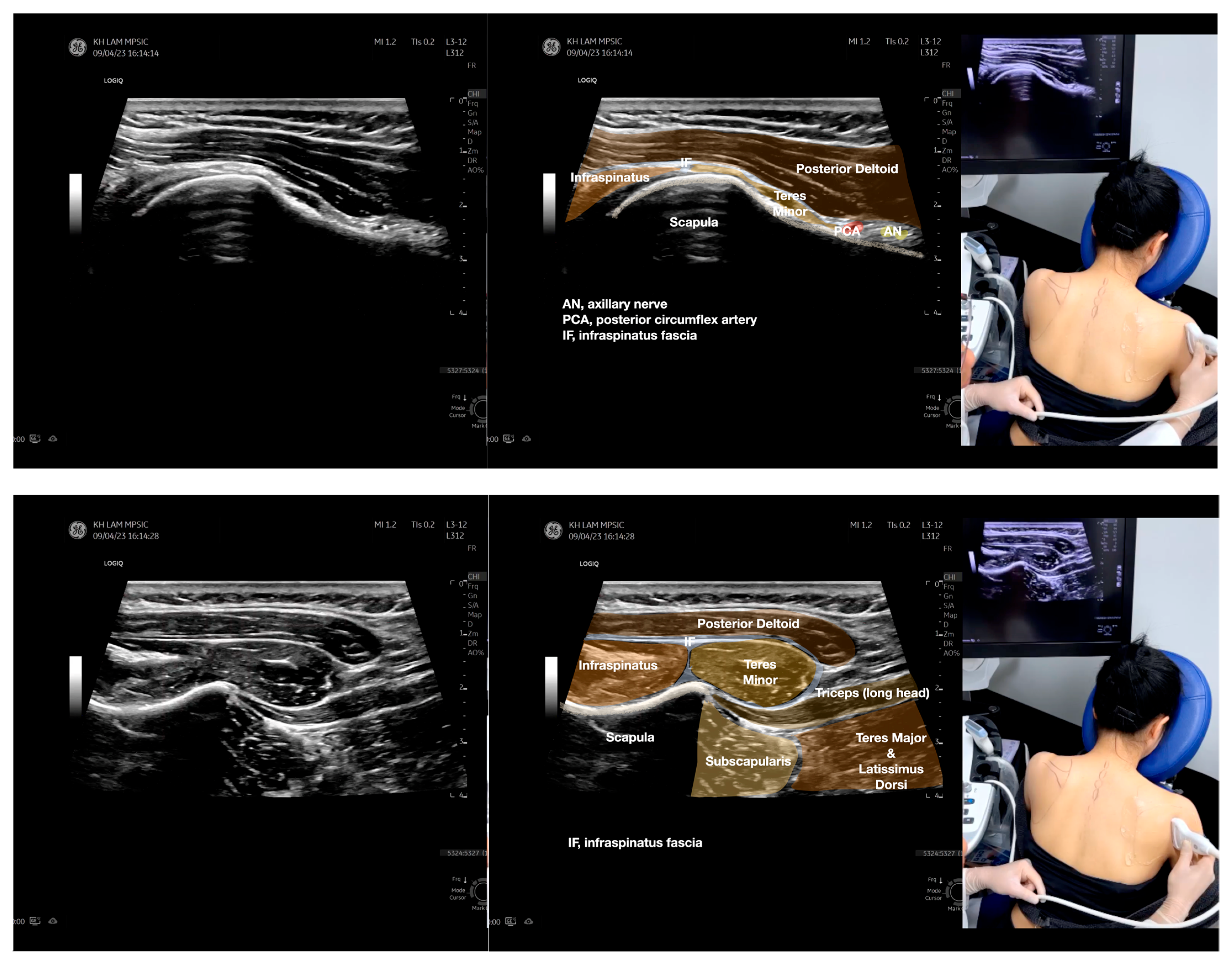 Diagnostics 13 02601 g005c Diagnostics 13 02601 g005c