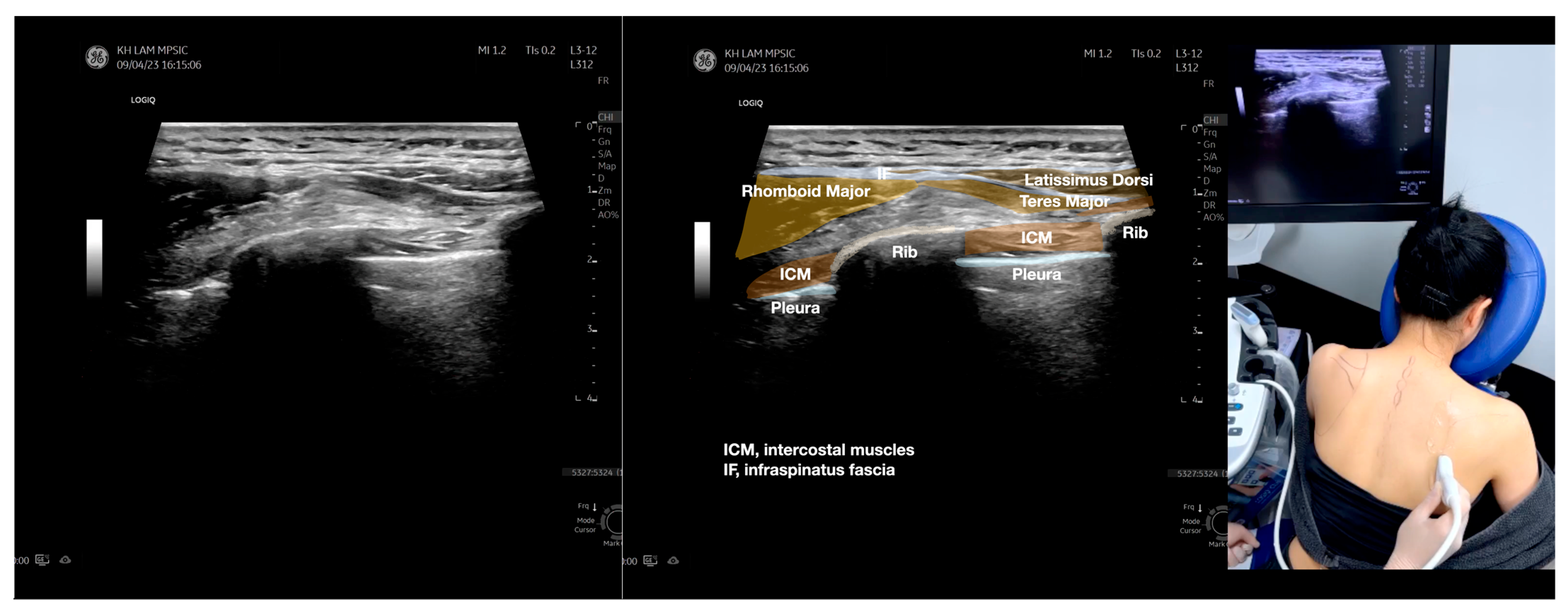 Diagnostics 13 02601 g005e Diagnostics 13 02601 g005e