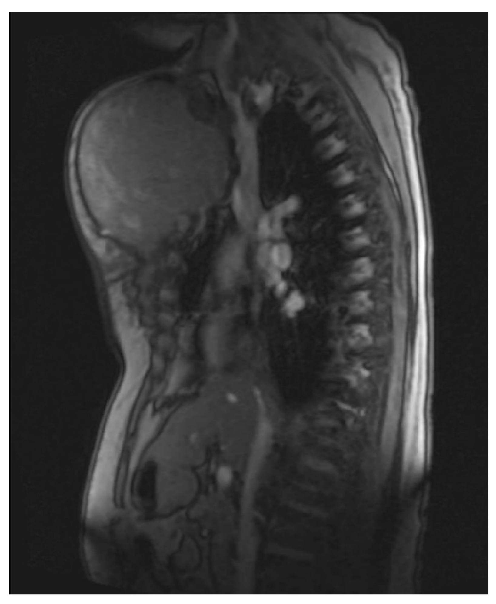 Diagnostics 13 02603 g004 Diagnostics 13 02603 g004