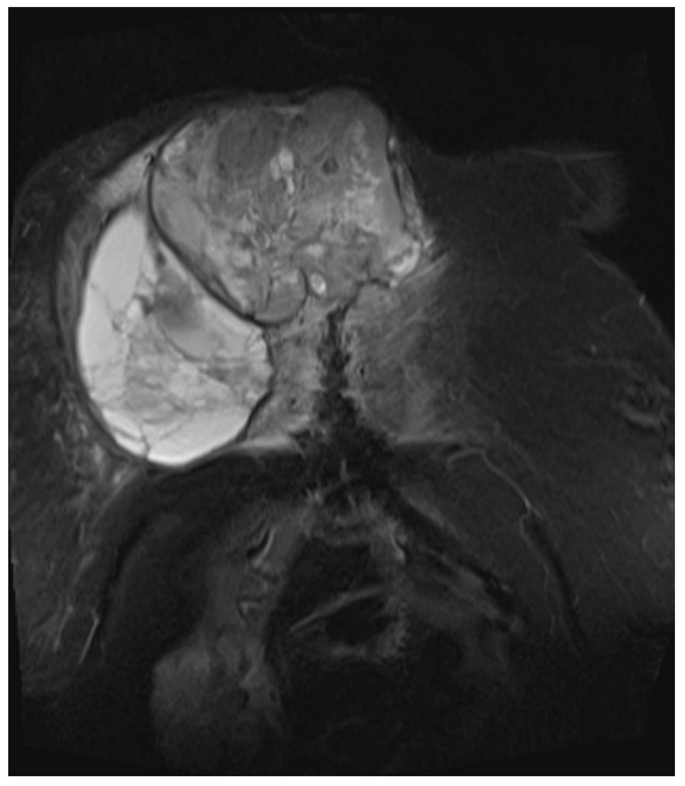 Diagnostics 13 02603 g005 Diagnostics 13 02603 g005