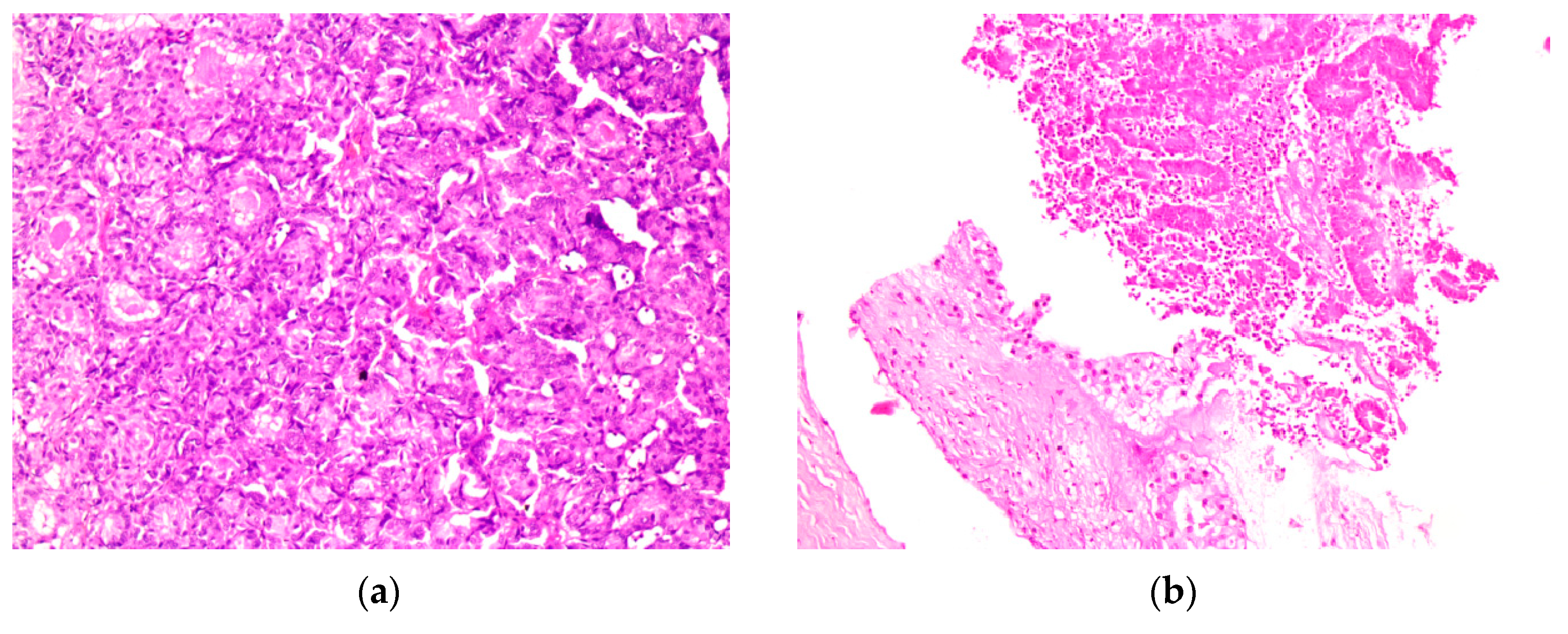 Diagnostics 13 02603 g006 Diagnostics 13 02603 g006