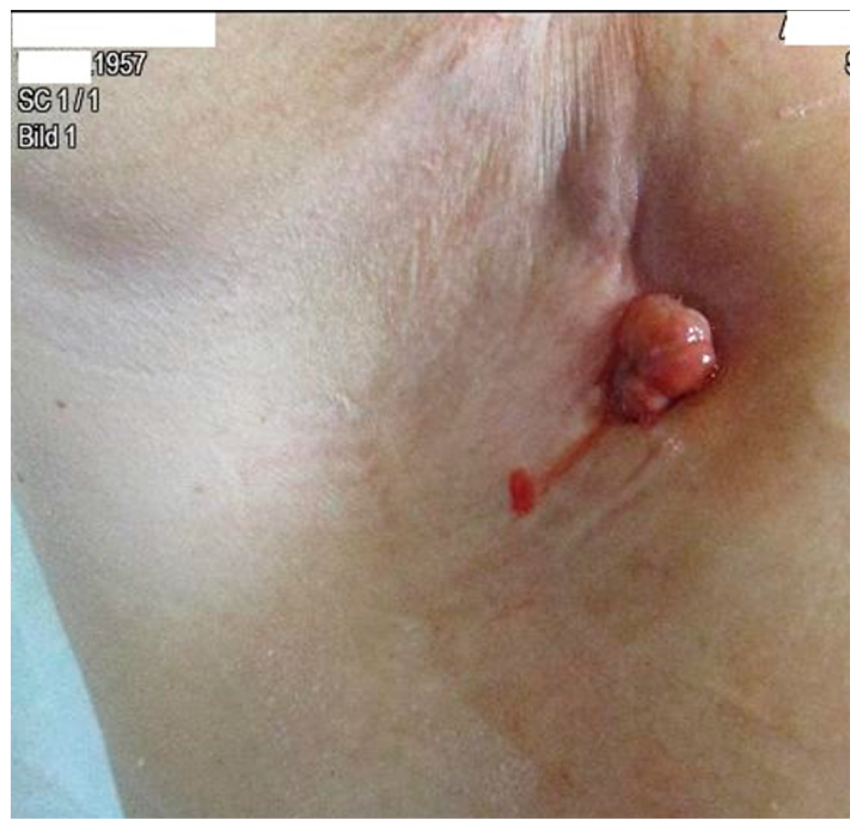 Diagnostics 13 02603 g007 Diagnostics 13 02603 g007