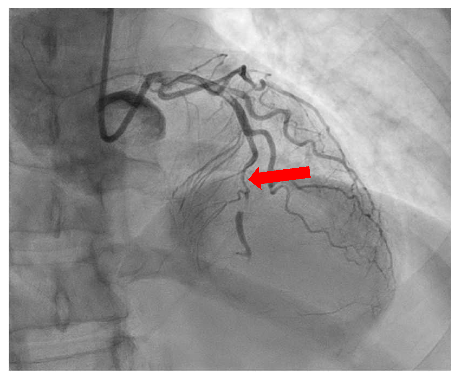 Diagnostics 13 02611 g005