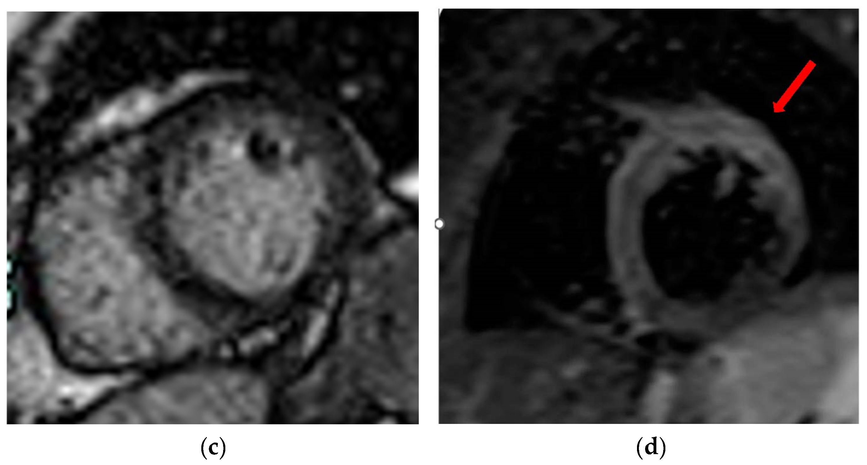 Diagnostics 13 02611 g008b
