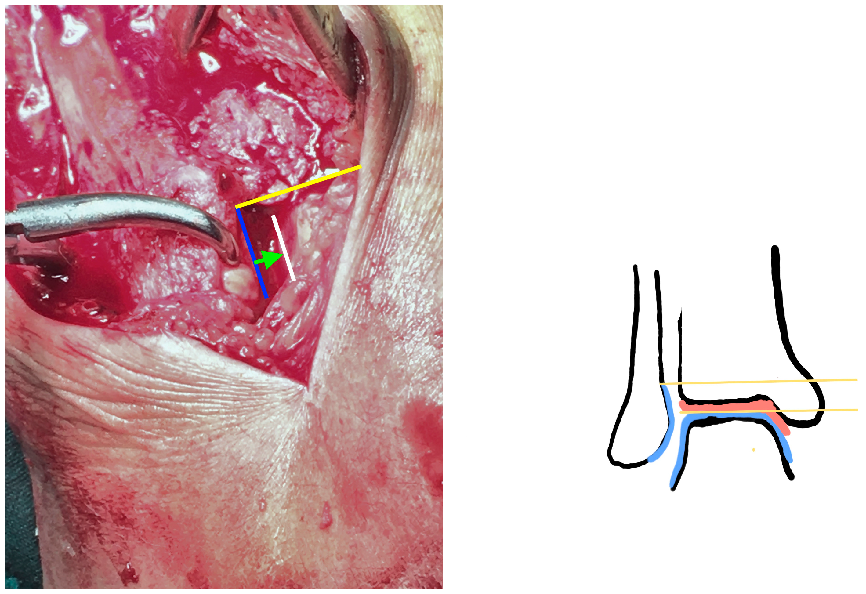 Diagnostics 13 02615 g002 Diagnostics 13 02615 g002