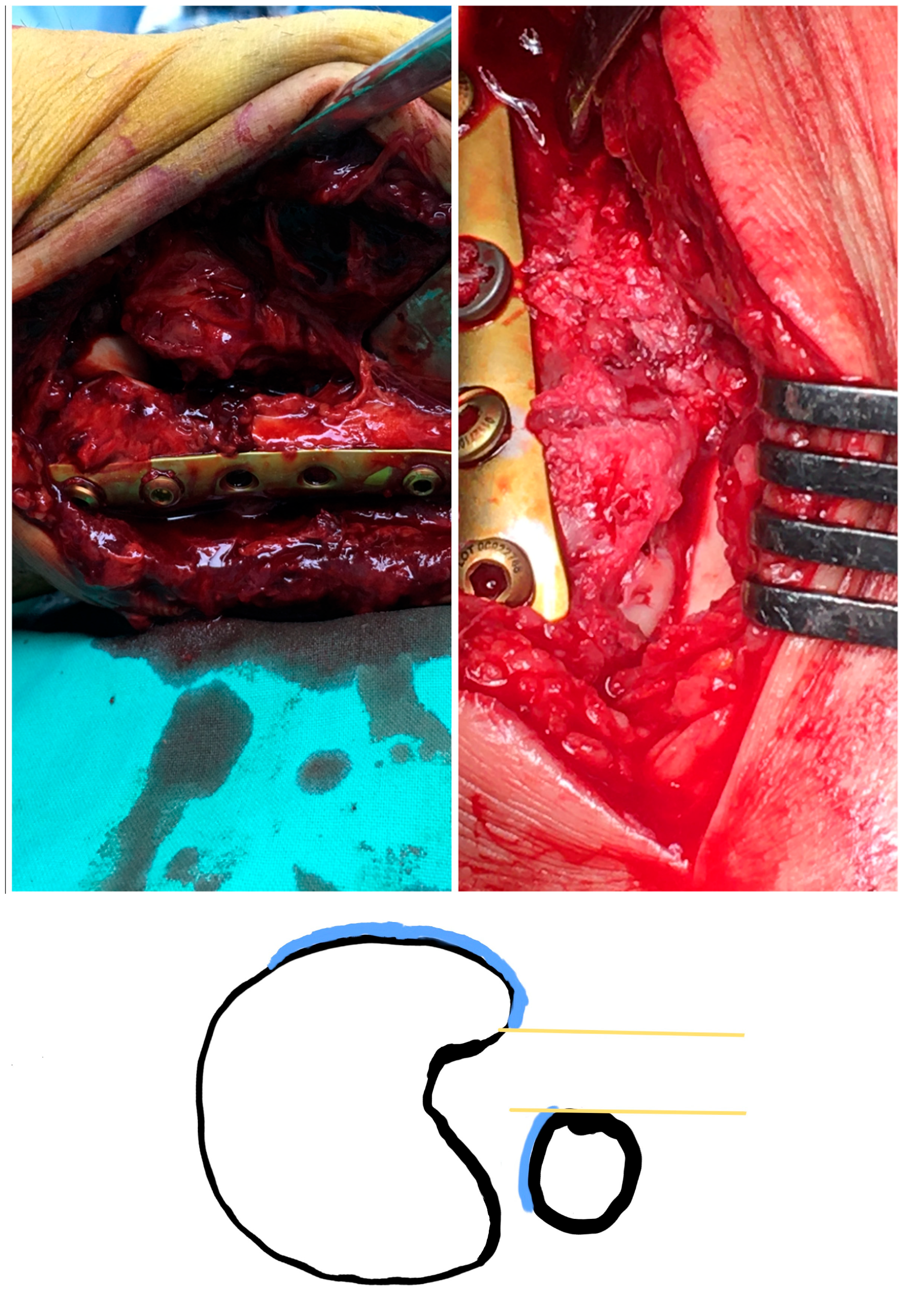 Diagnostics 13 02615 g003 Diagnostics 13 02615 g003