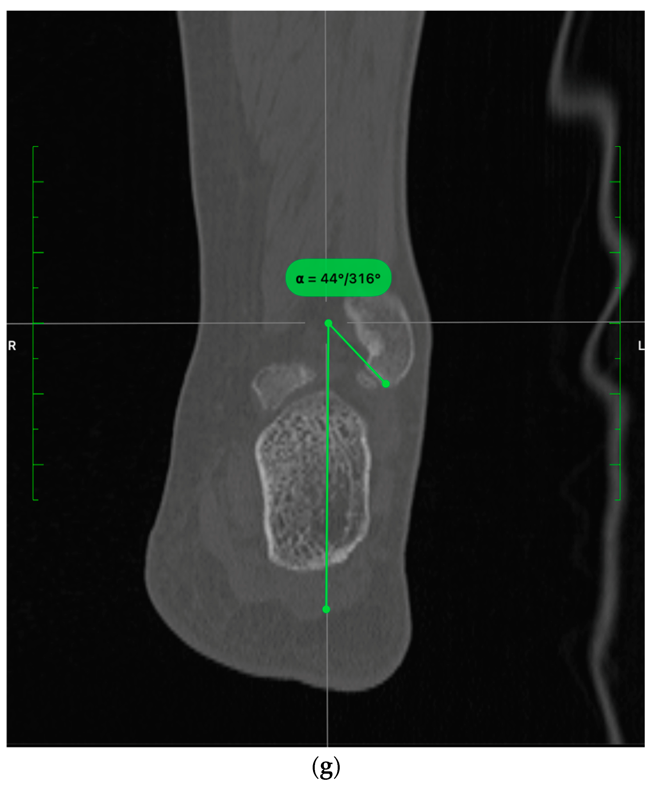 Diagnostics 13 02615 g004b Diagnostics 13 02615 g004b