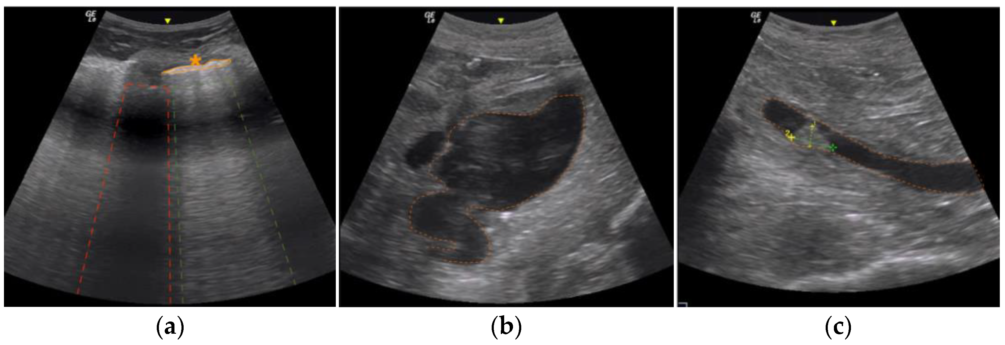 Diagnostics 13 02643 g001
