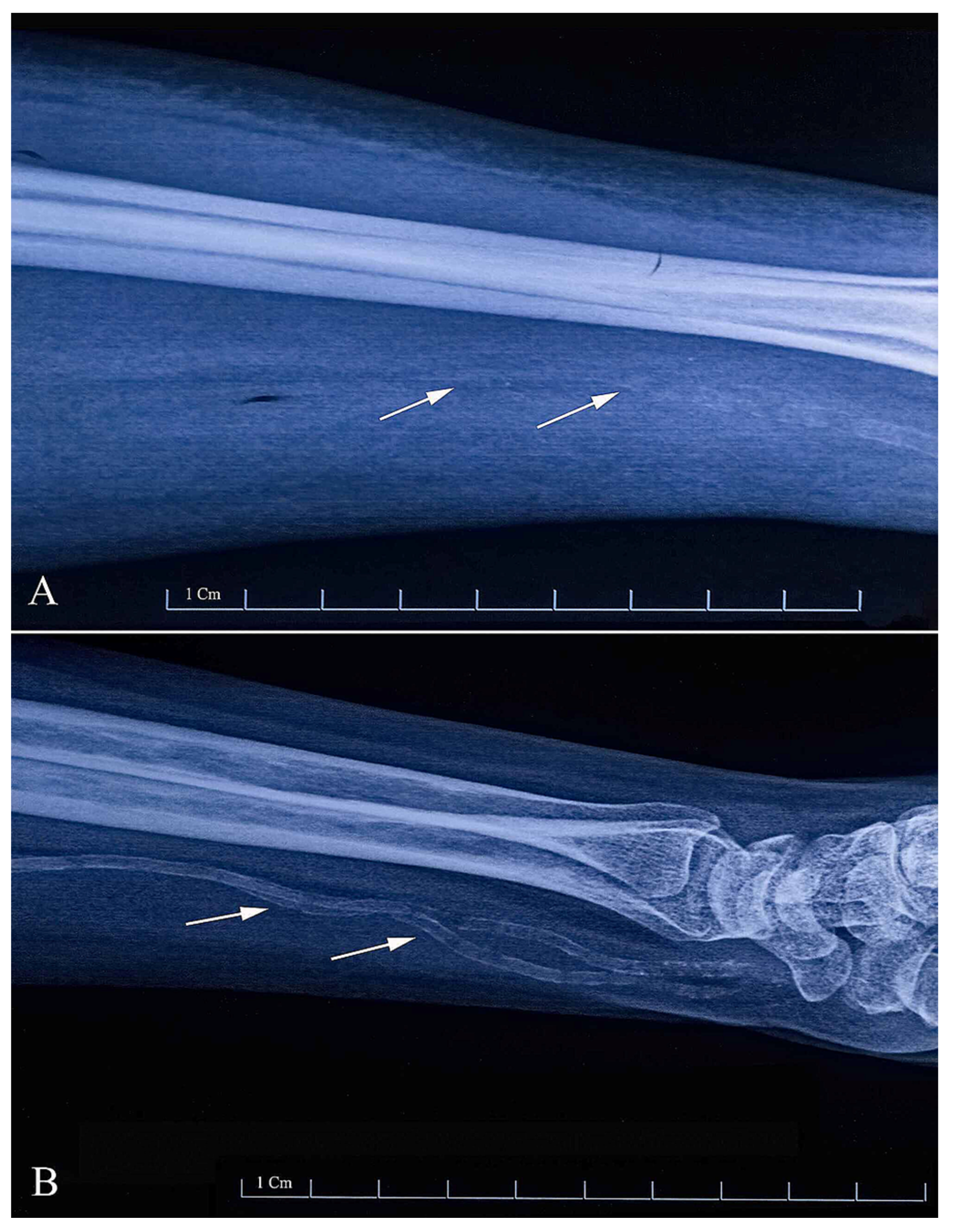 Diagnostics 13 02660 g001