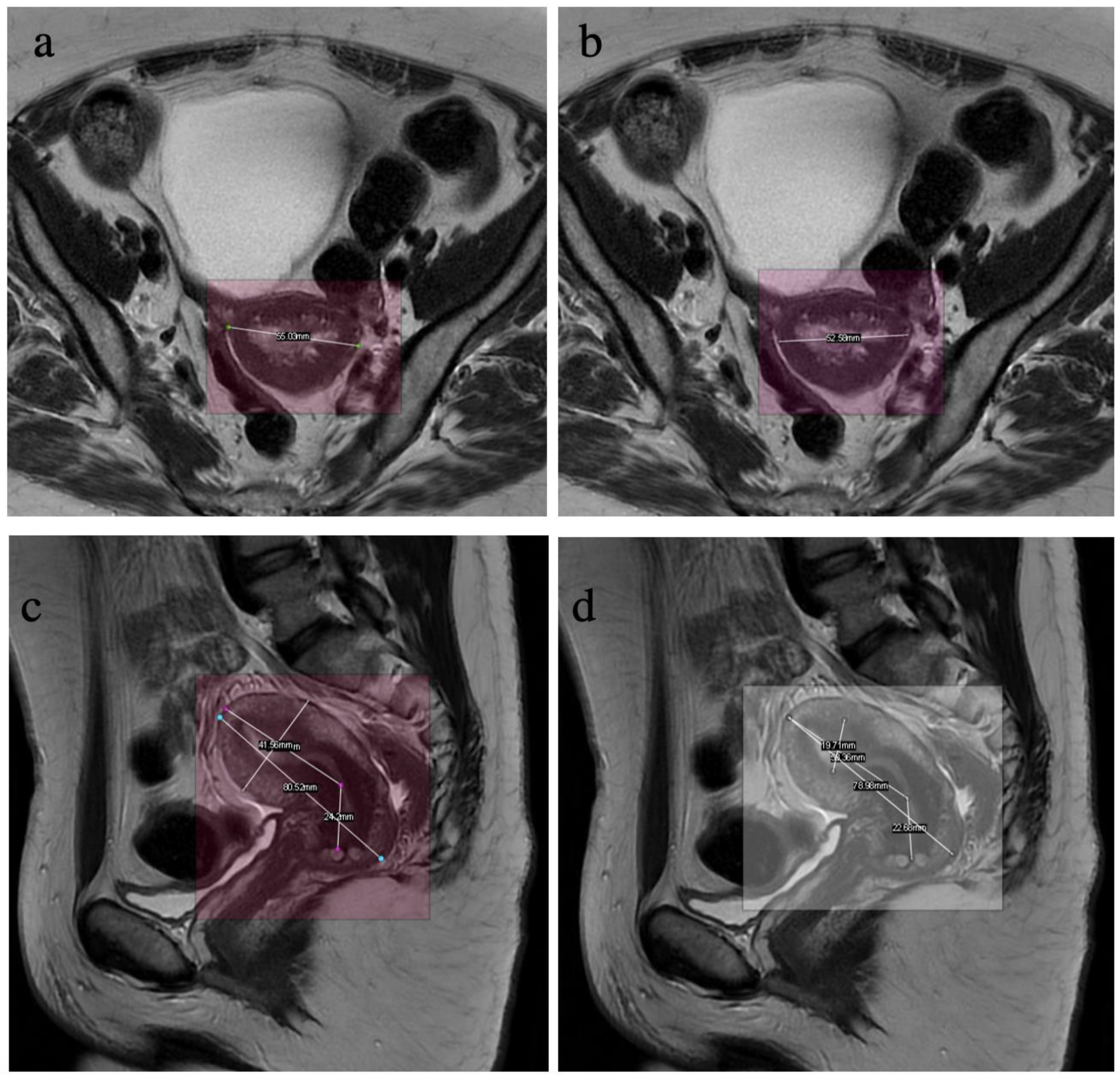 Diagnostics 13 02662 g005 Diagnostics 13 02662 g005