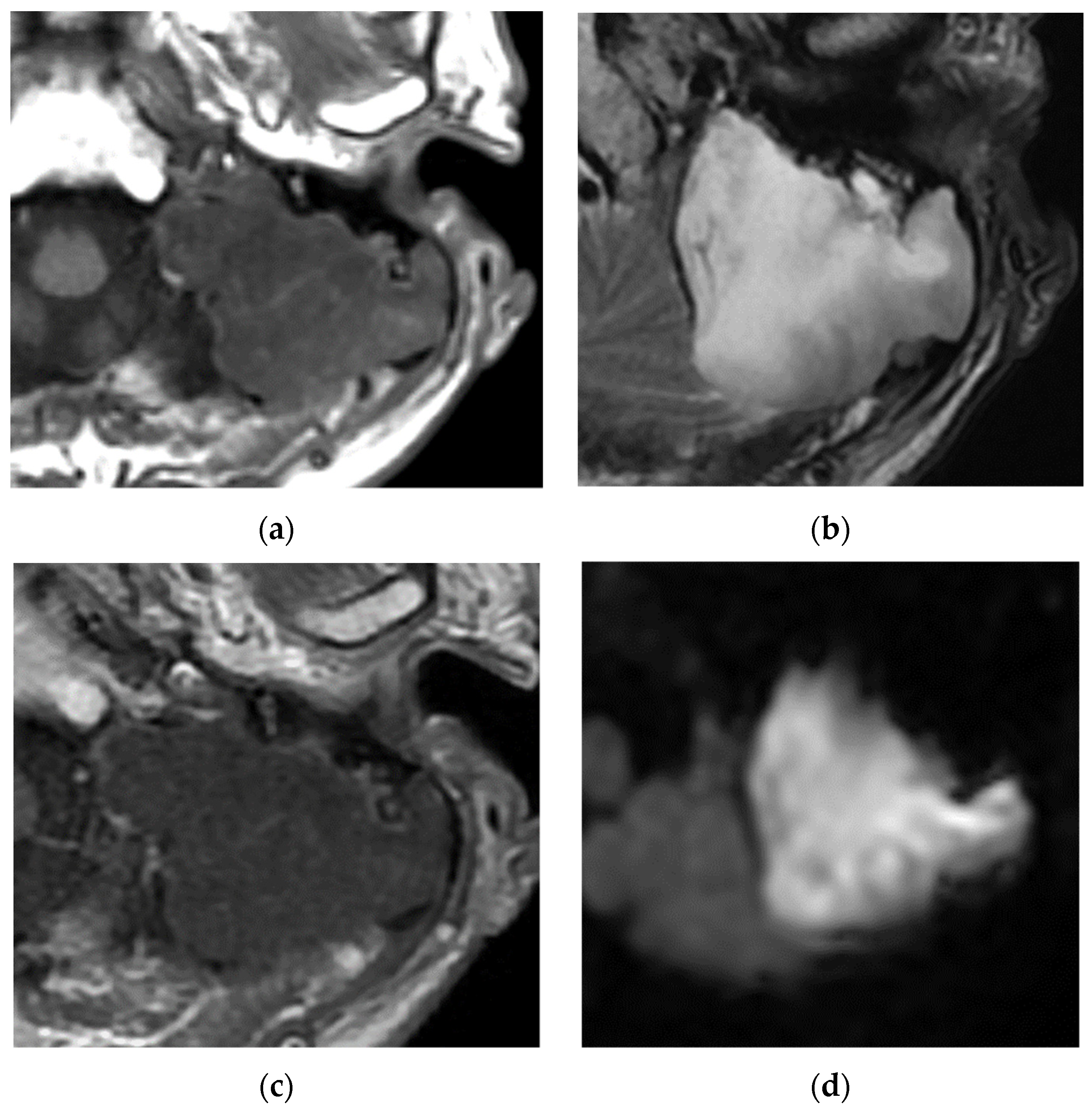 Diagnostics 13 02665 g004 Diagnostics 13 02665 g004