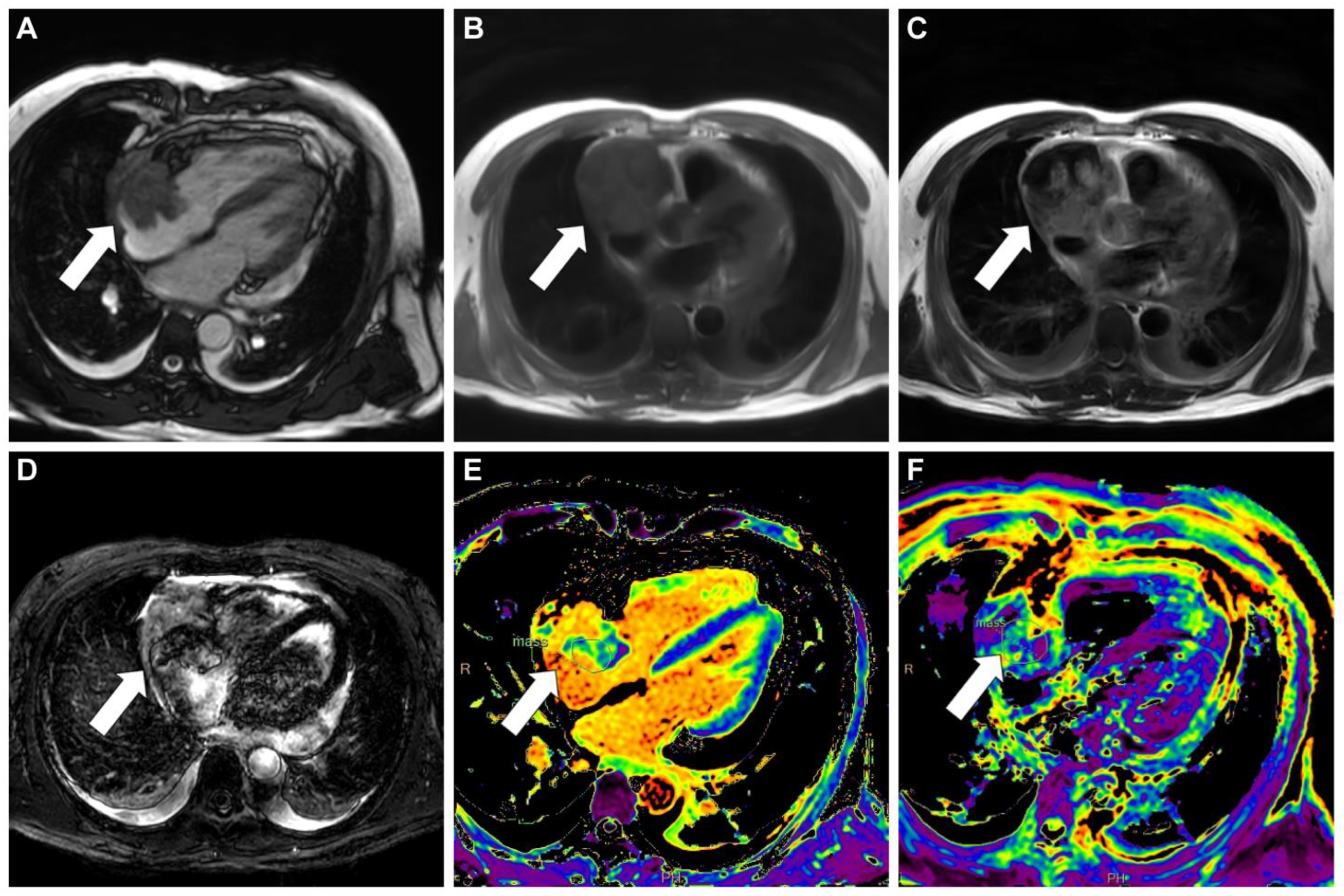 Diagnostics 13 02666 g002