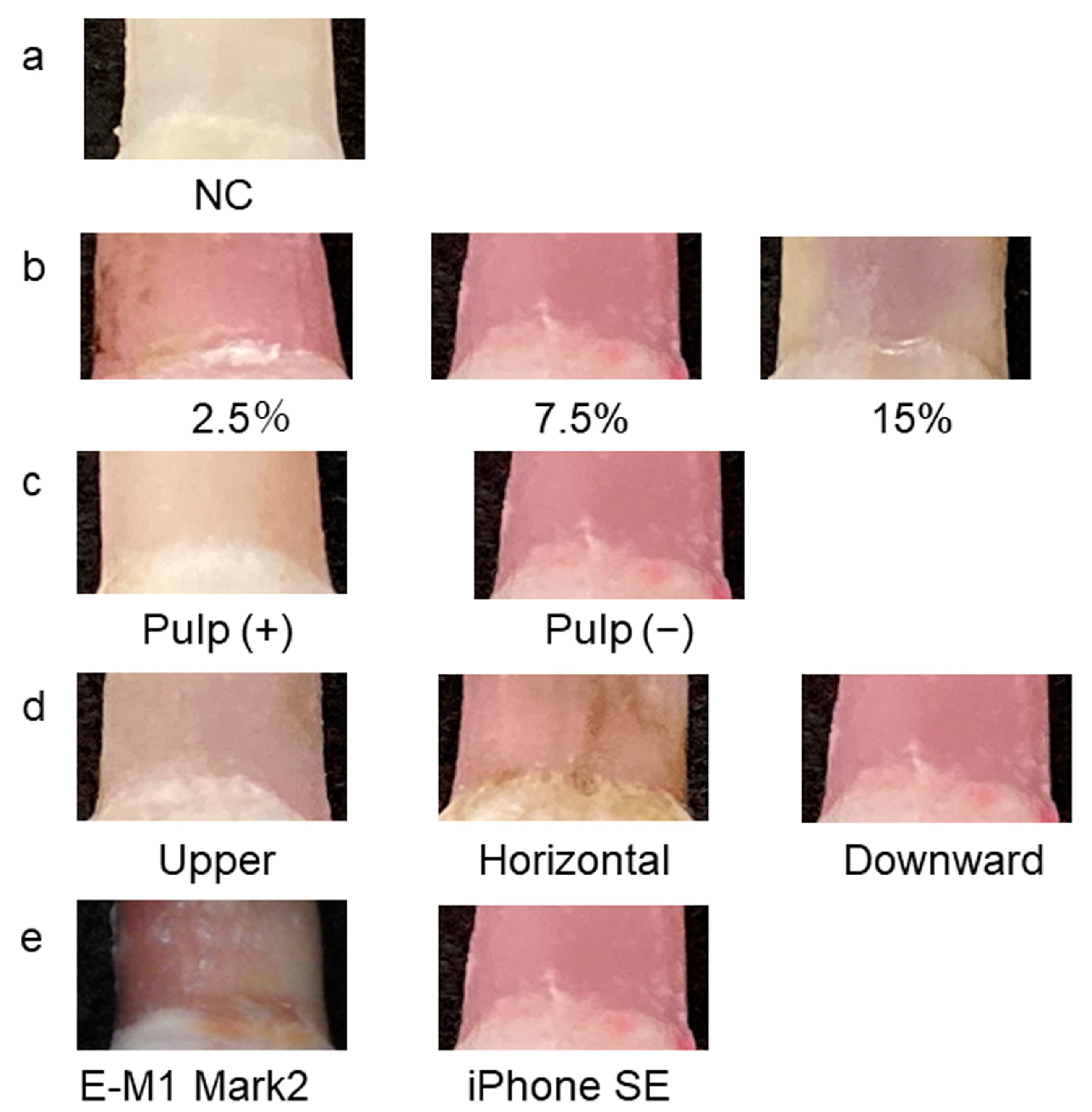 Diagnostics Free FullText Study on the Mechanism of the Pink Tooth