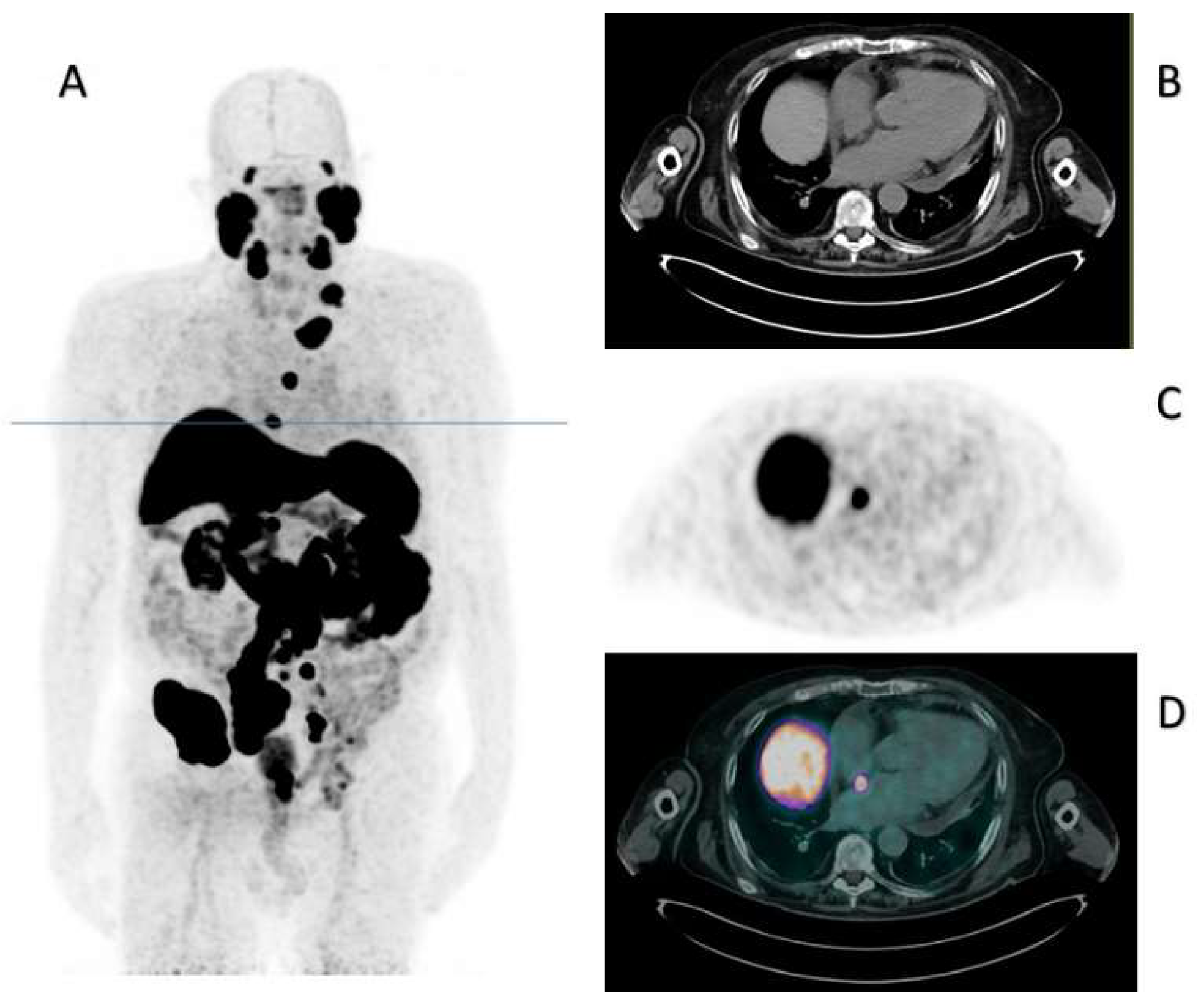 Diagnostics 13 02733 g001