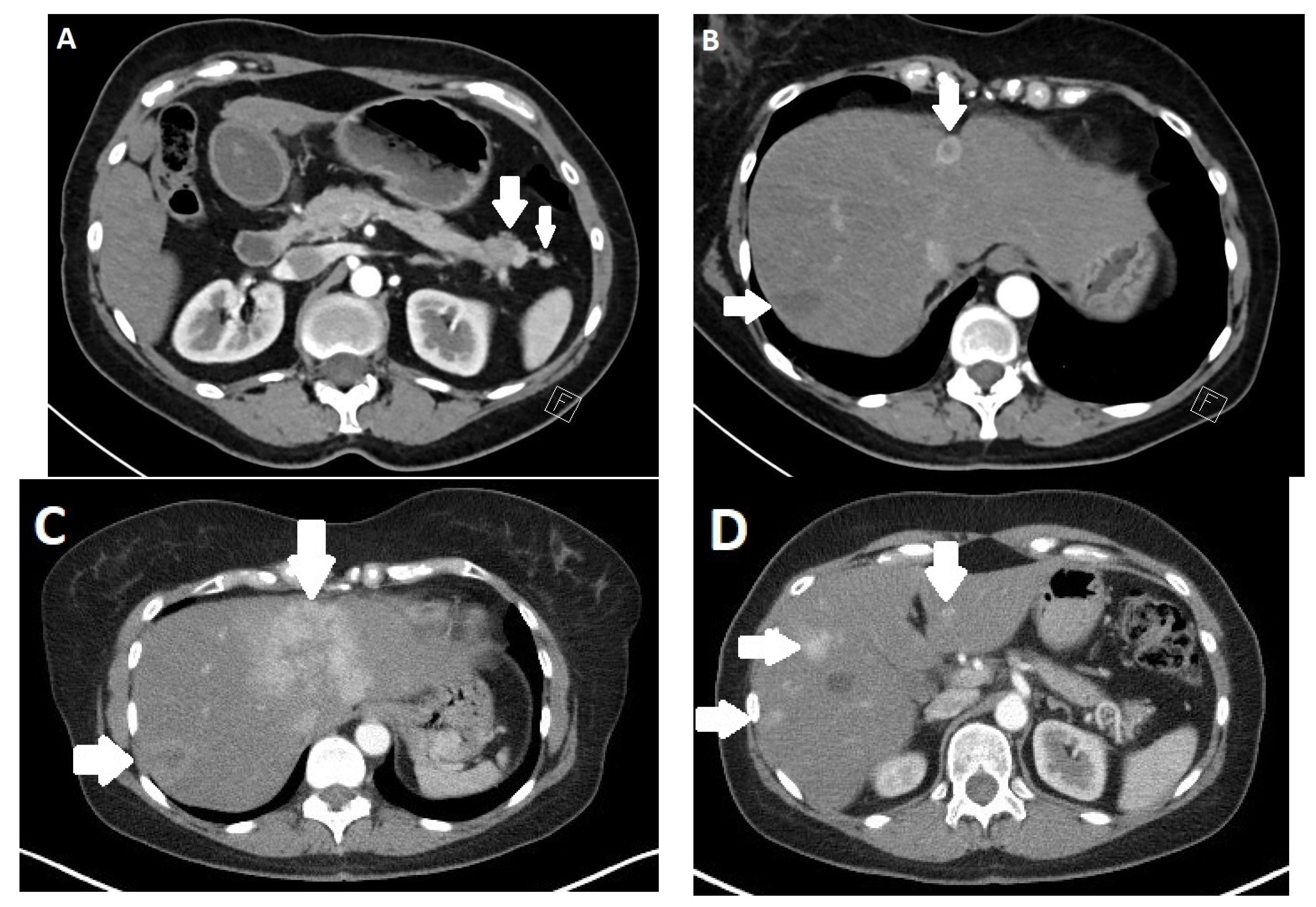 Diagnostics 13 02741 g003