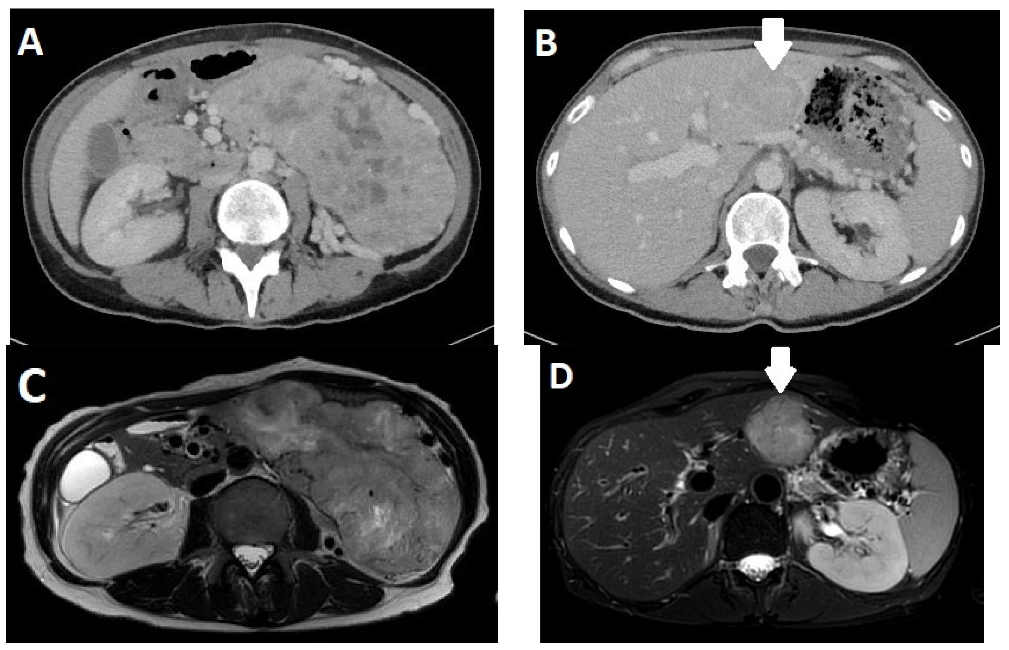 Diagnostics 13 02741 g004