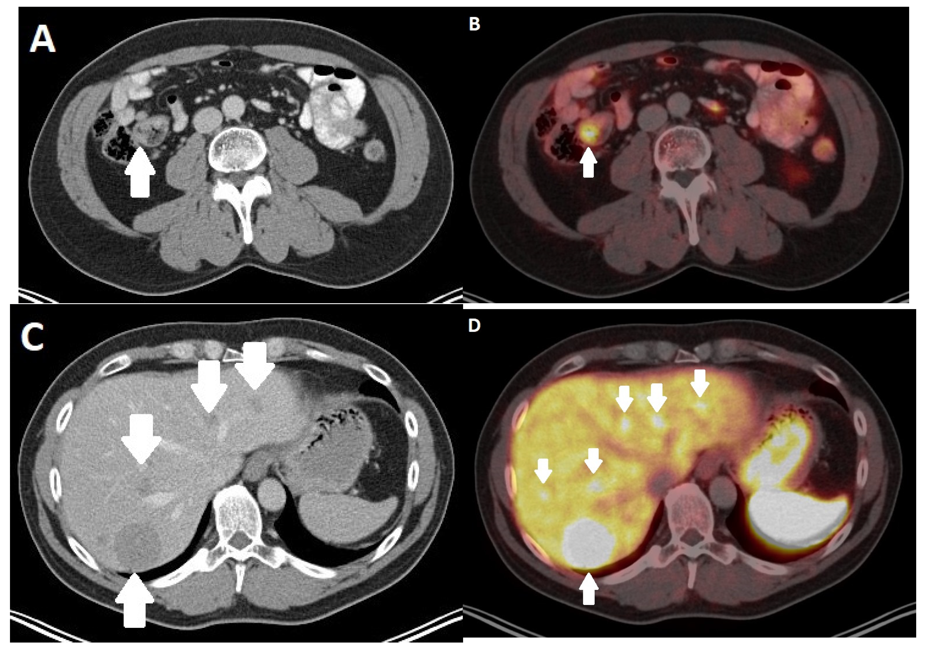 Diagnostics 13 02741 g005