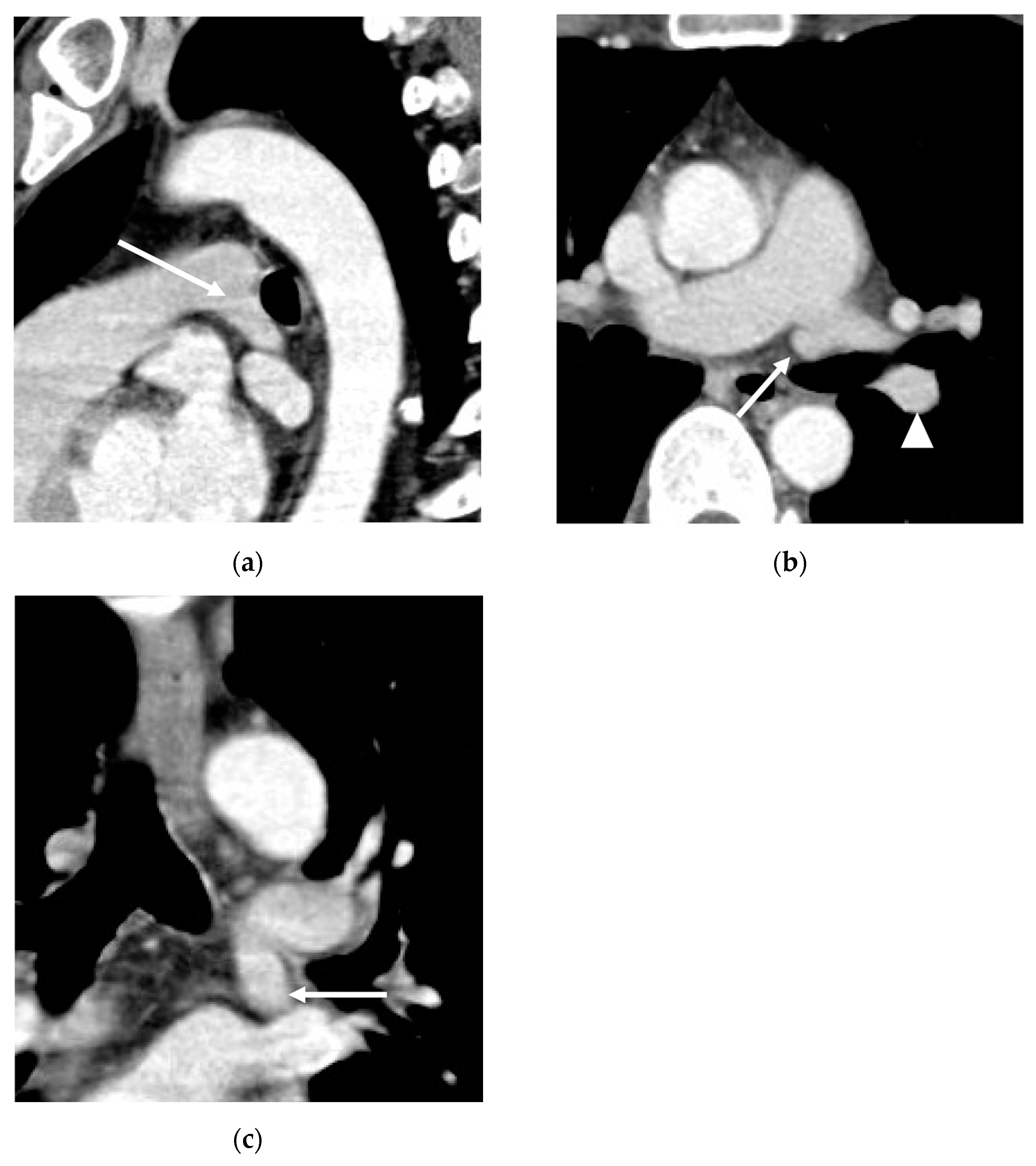 Diagnostics 13 02744 g001 Diagnostics 13 02744 g001