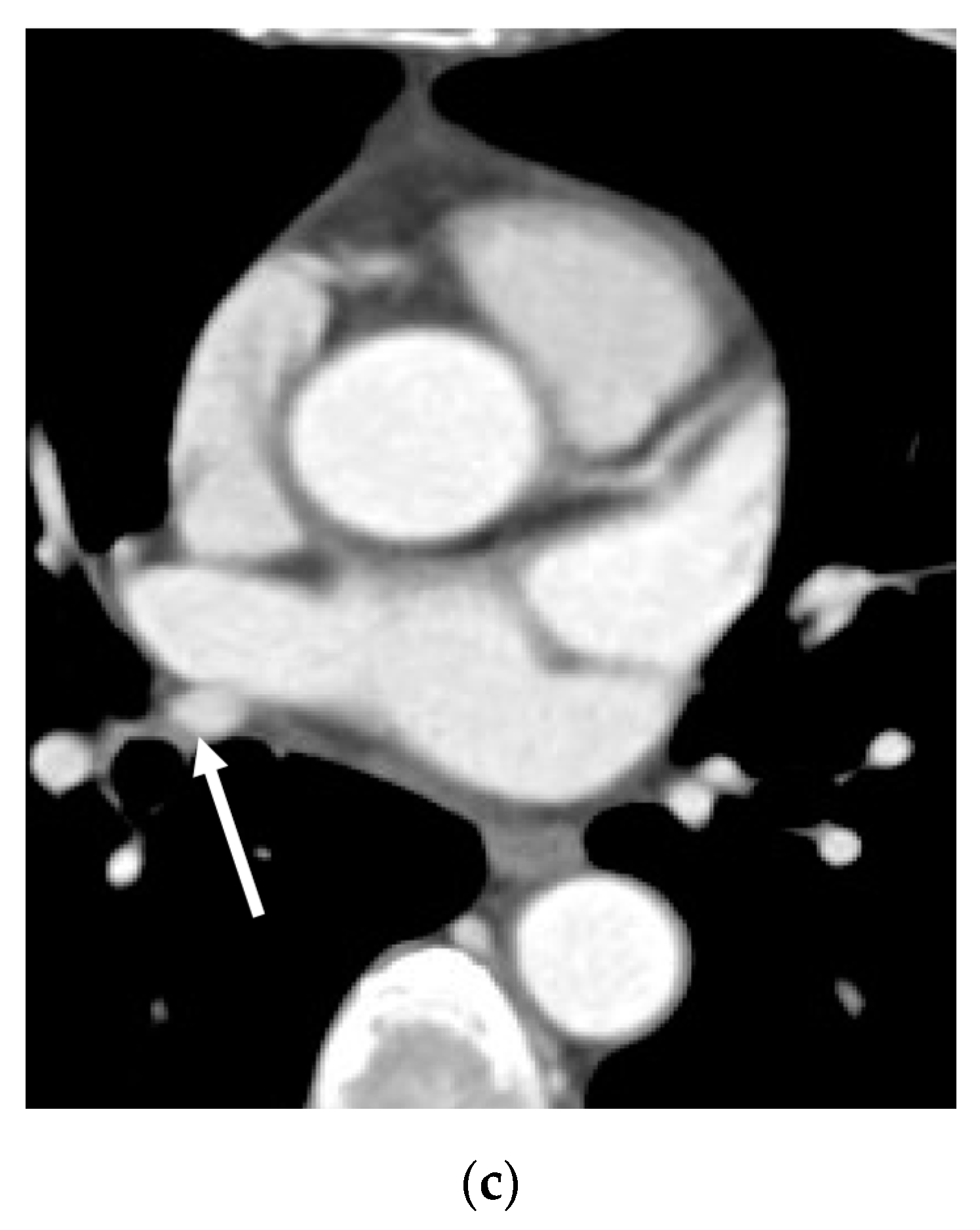 Diagnostics 13 02744 g002b Diagnostics 13 02744 g002b