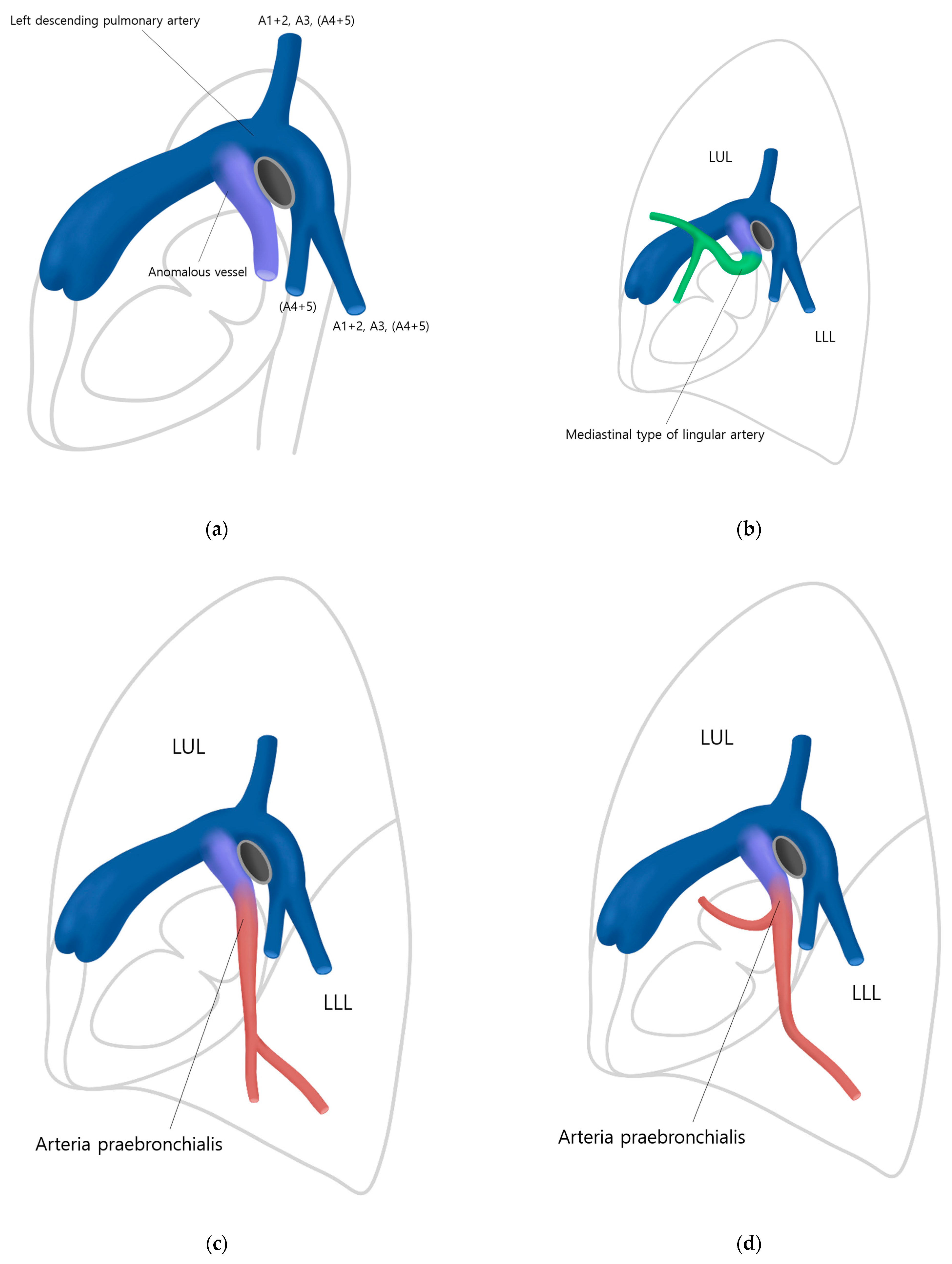 Diagnostics 13 02744 g005a Diagnostics 13 02744 g005a