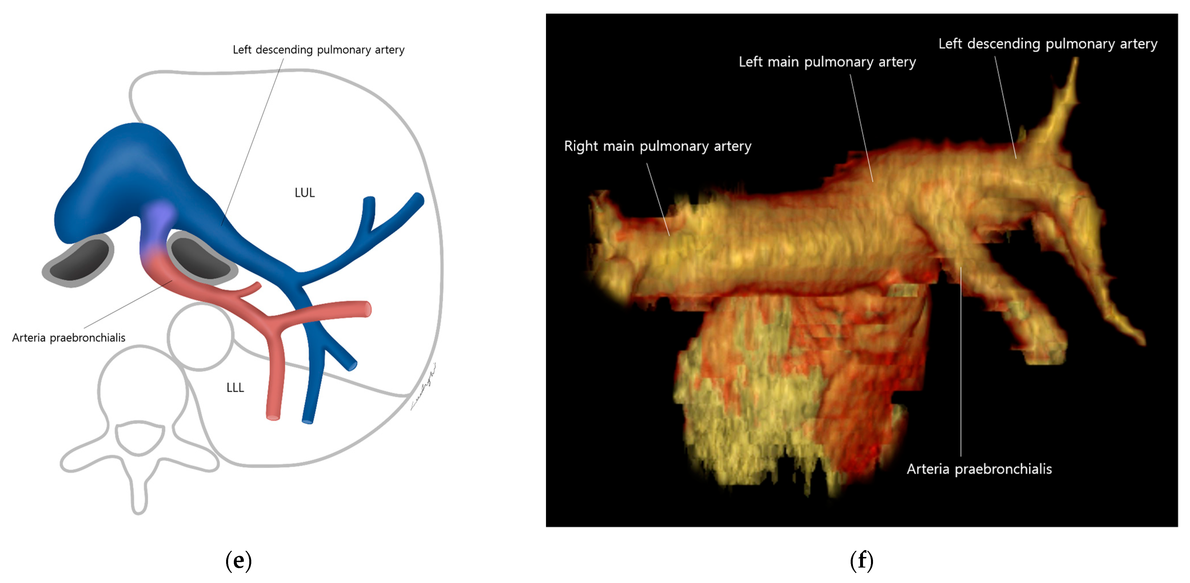Diagnostics 13 02744 g005b Diagnostics 13 02744 g005b