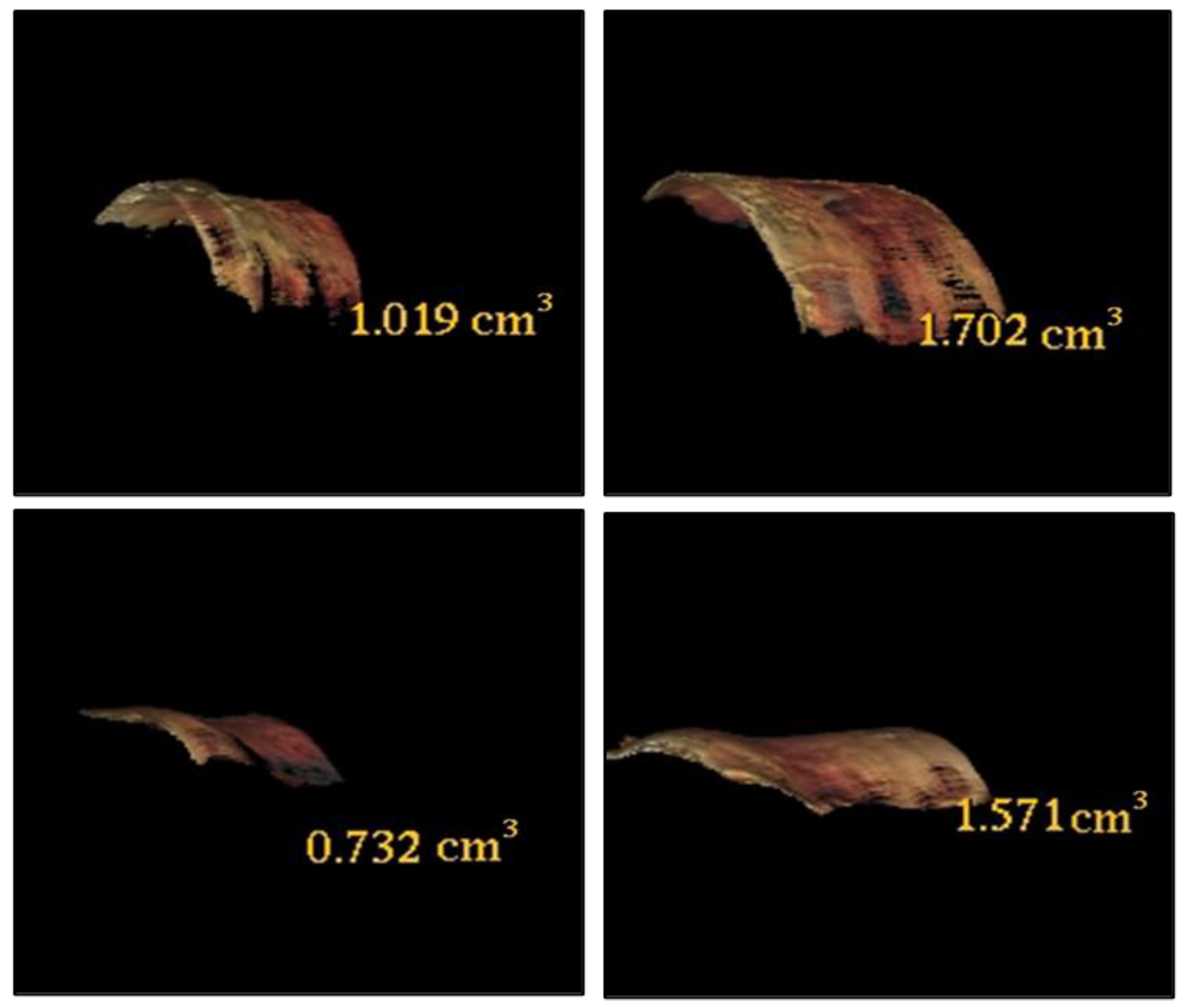Diagnostics 13 02750 g0a5 Diagnostics 13 02750 g0a5