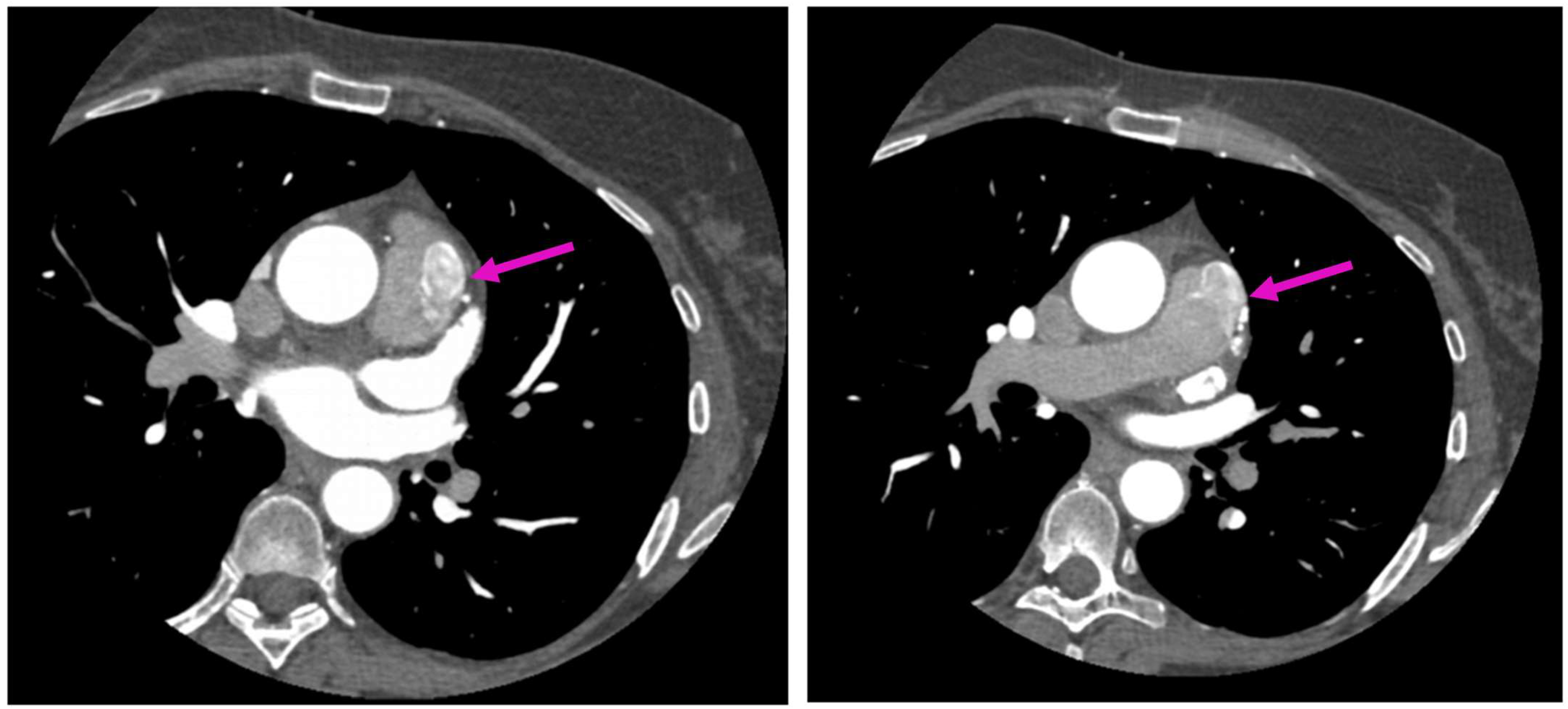 Diagnostics 13 02751 g002 Diagnostics 13 02751 g002