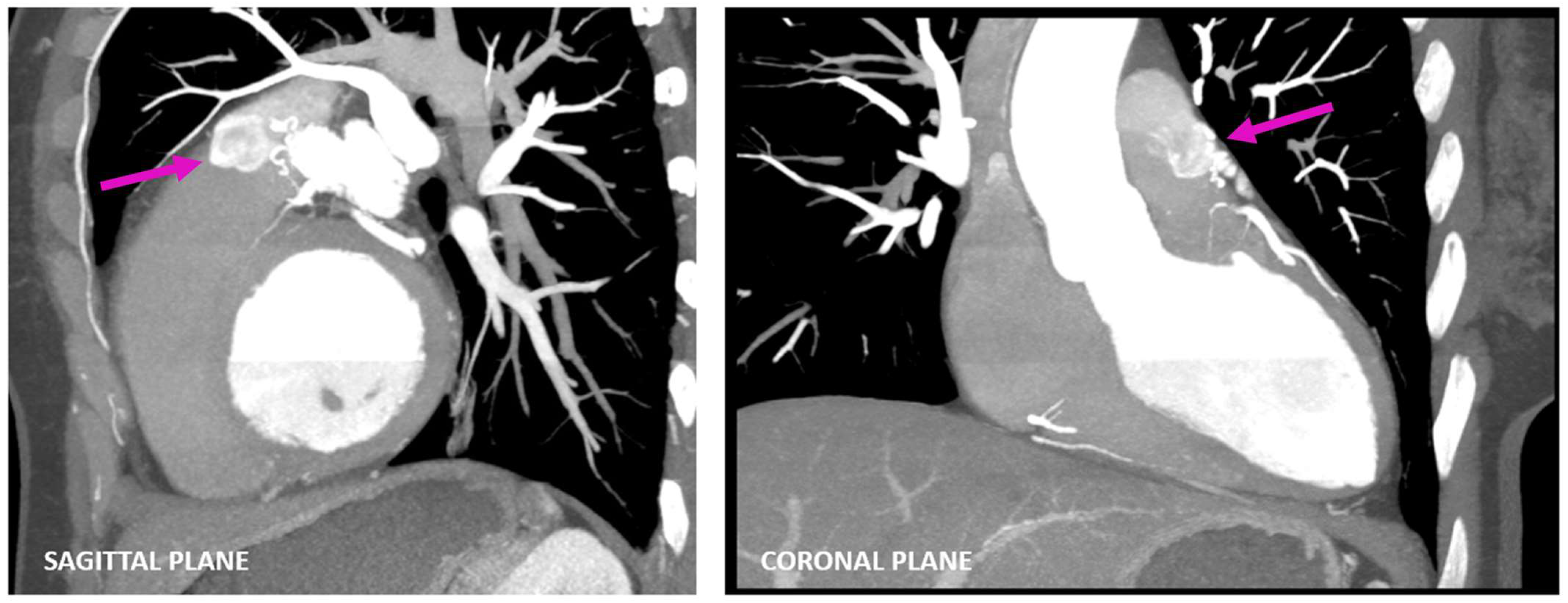 Diagnostics 13 02751 g003 Diagnostics 13 02751 g003