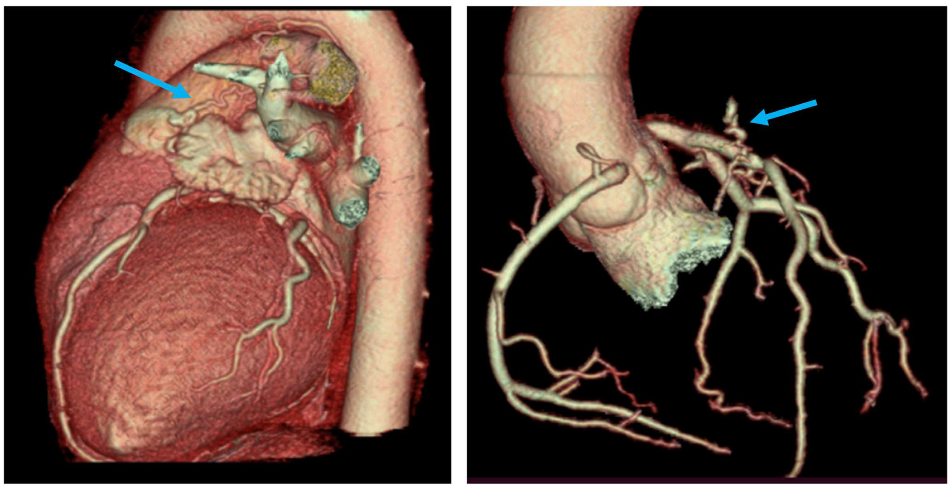 Diagnostics 13 02751 g004 Diagnostics 13 02751 g004