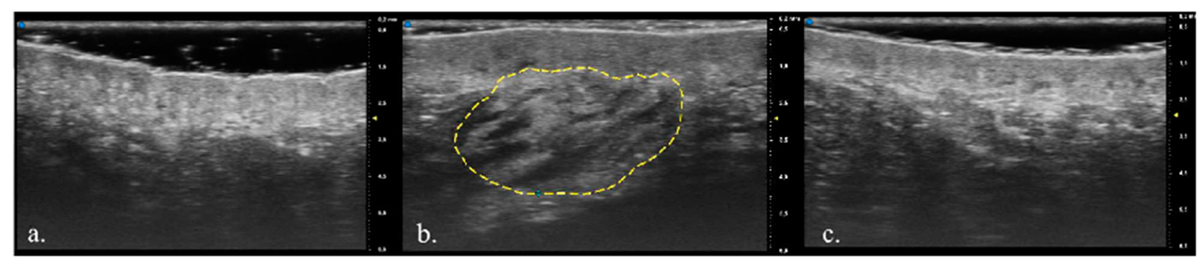 Diagnostics 13 02761 g001