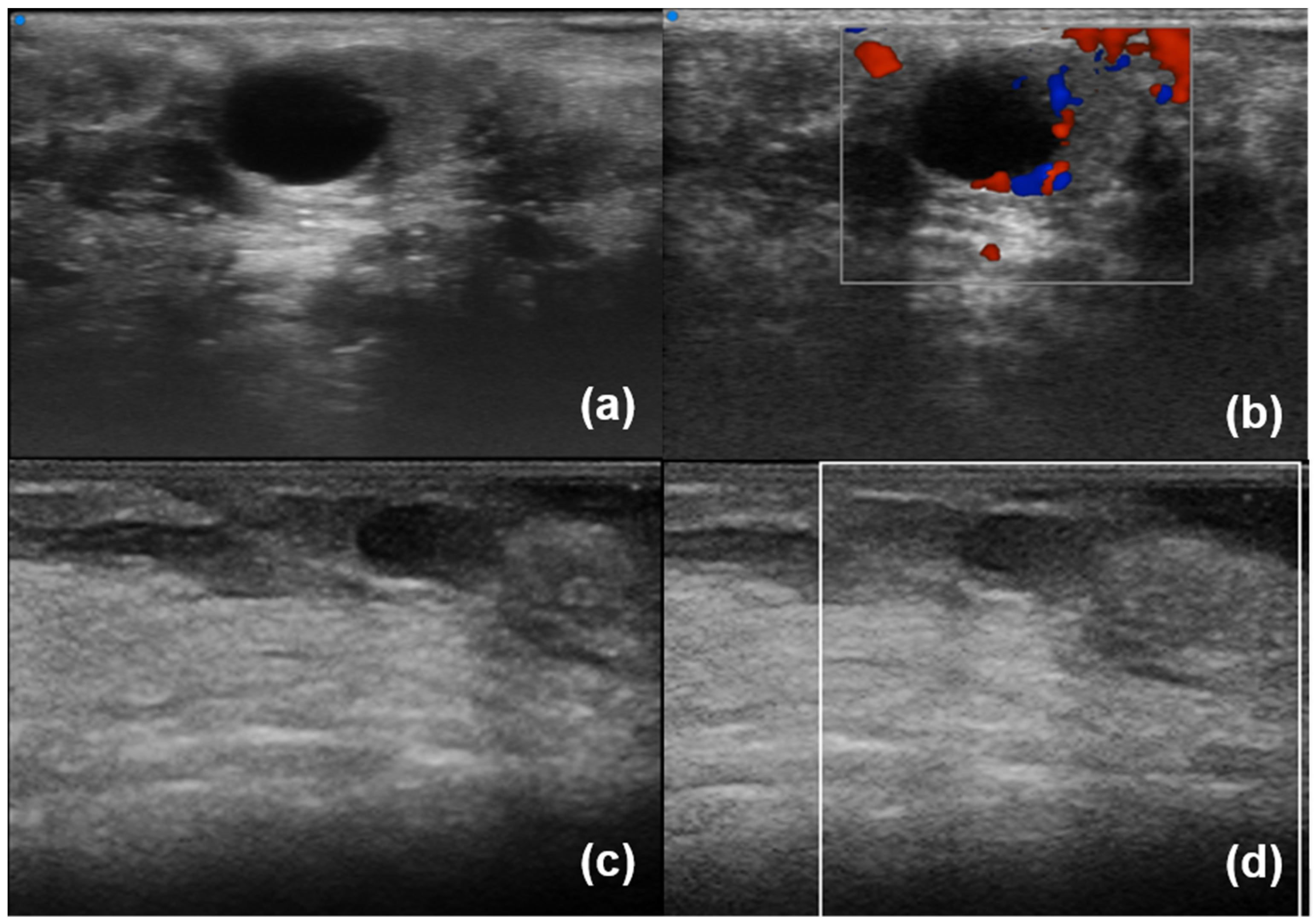 Diagnostics 13 02771 g004