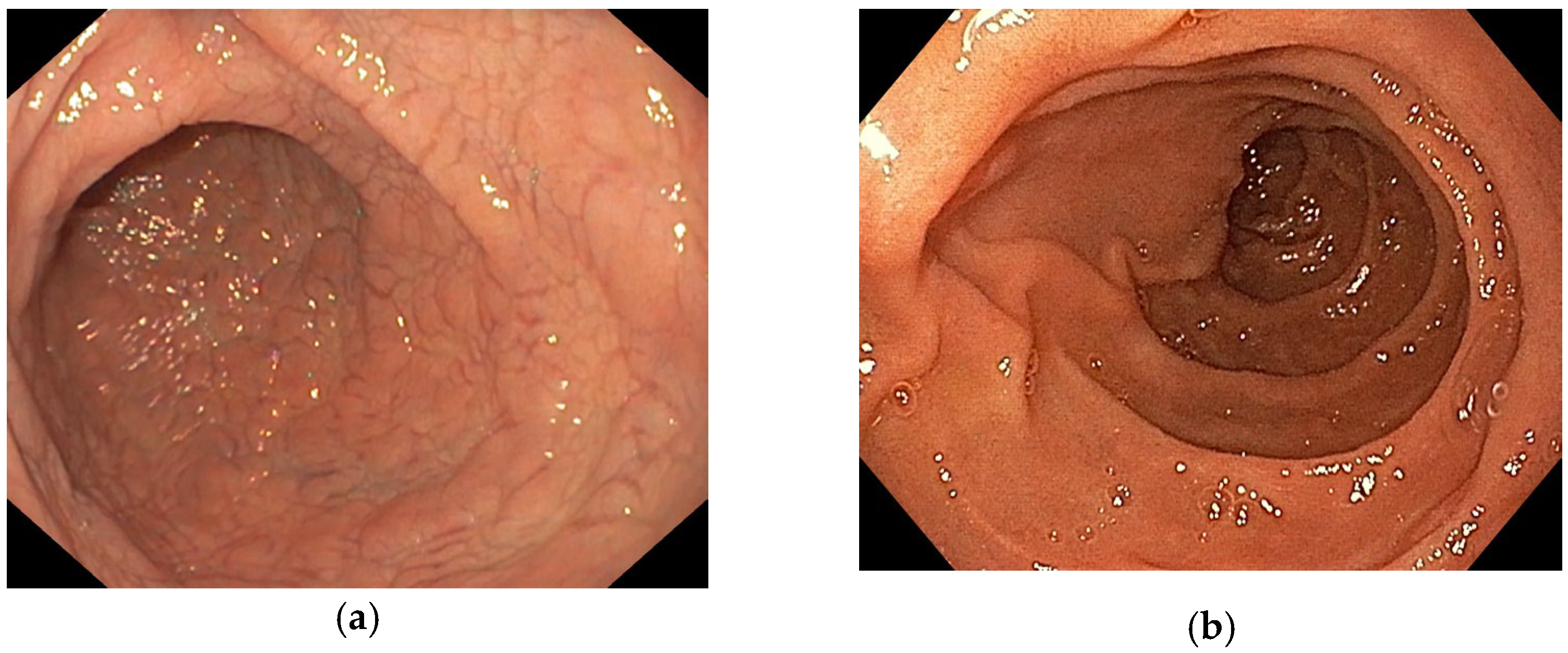 Diagnostics 13 02780 g002 Diagnostics 13 02780 g002