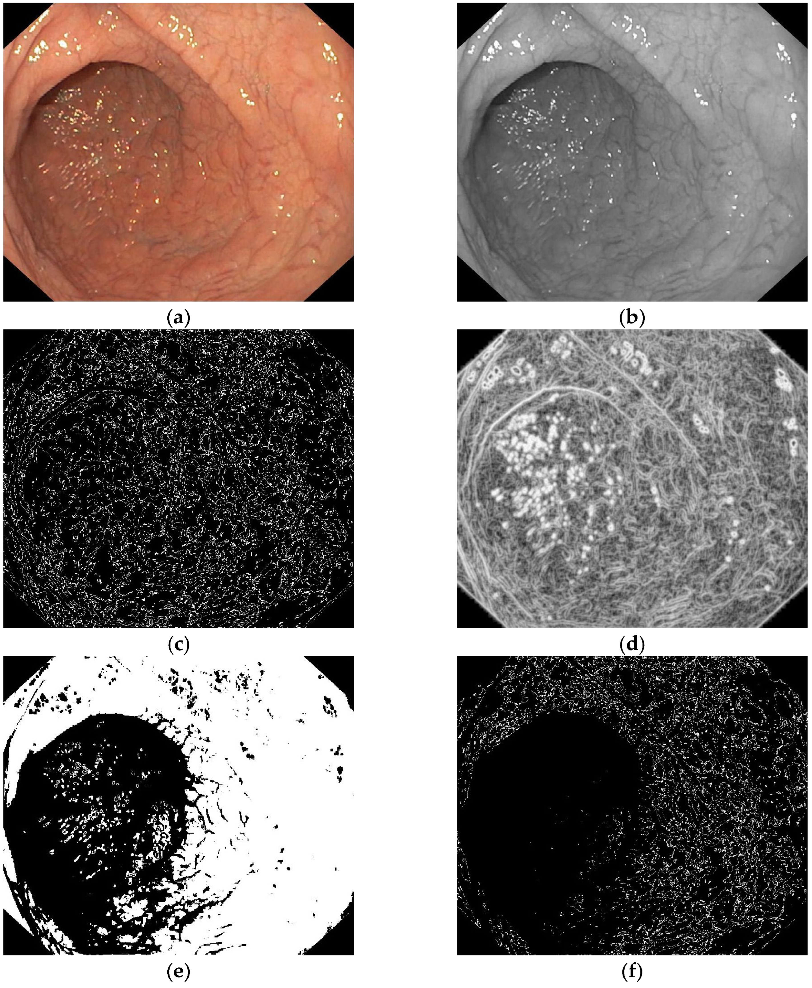 Diagnostics 13 02780 g003a Diagnostics 13 02780 g003a