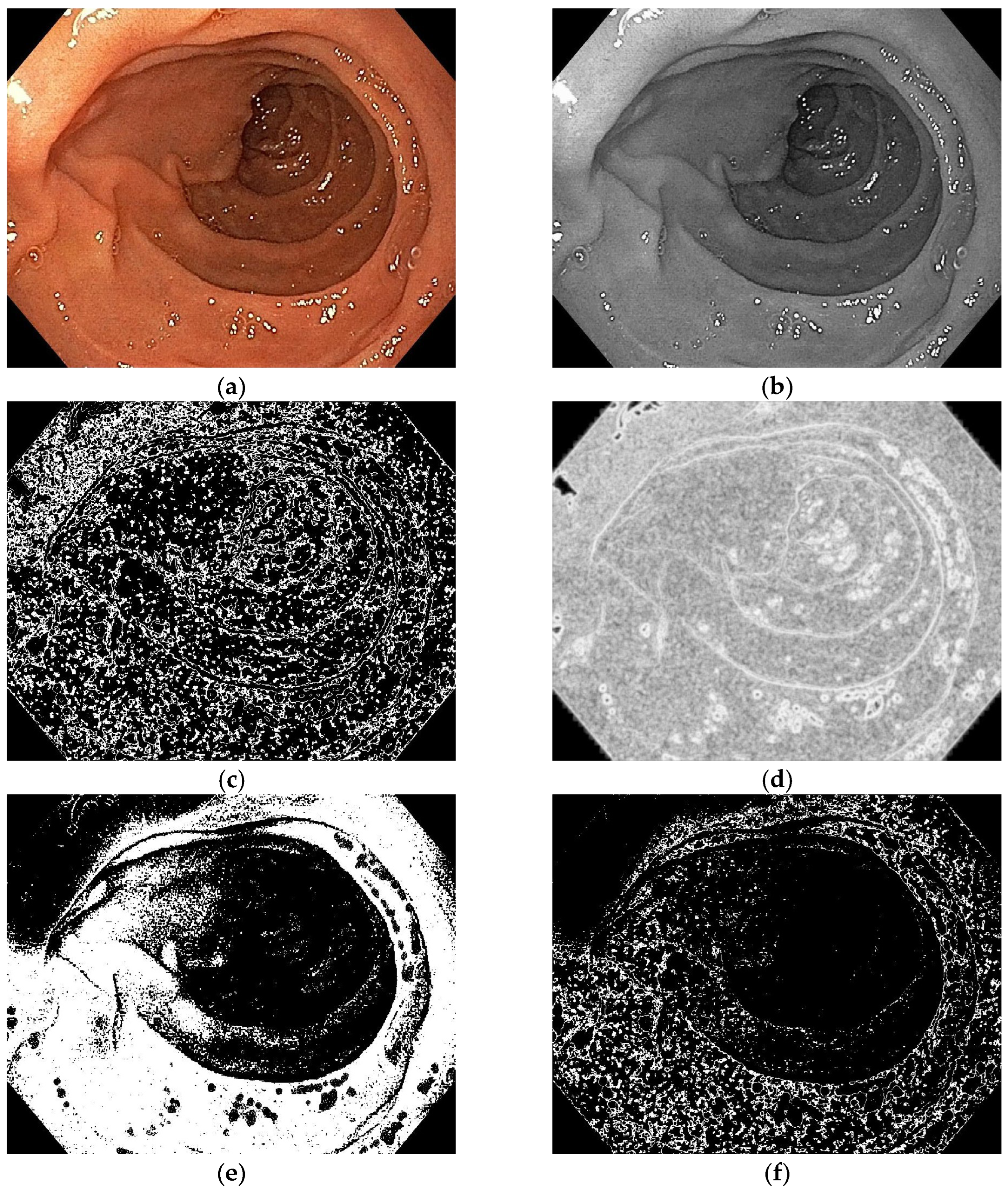Diagnostics 13 02780 g004a Diagnostics 13 02780 g004a