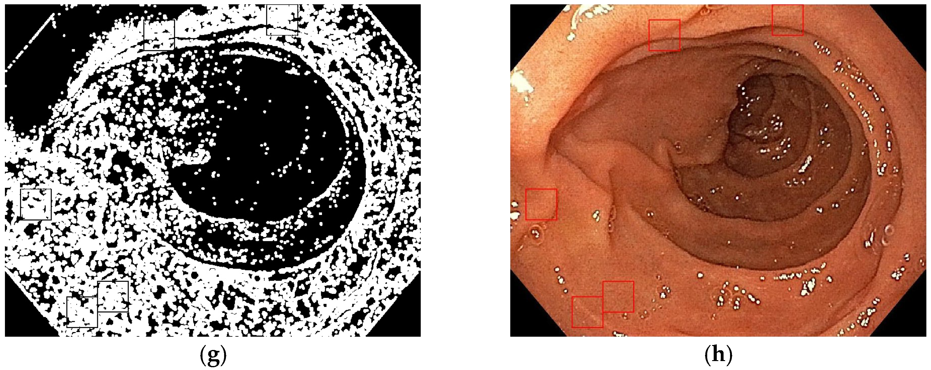 Diagnostics 13 02780 g004b Diagnostics 13 02780 g004b