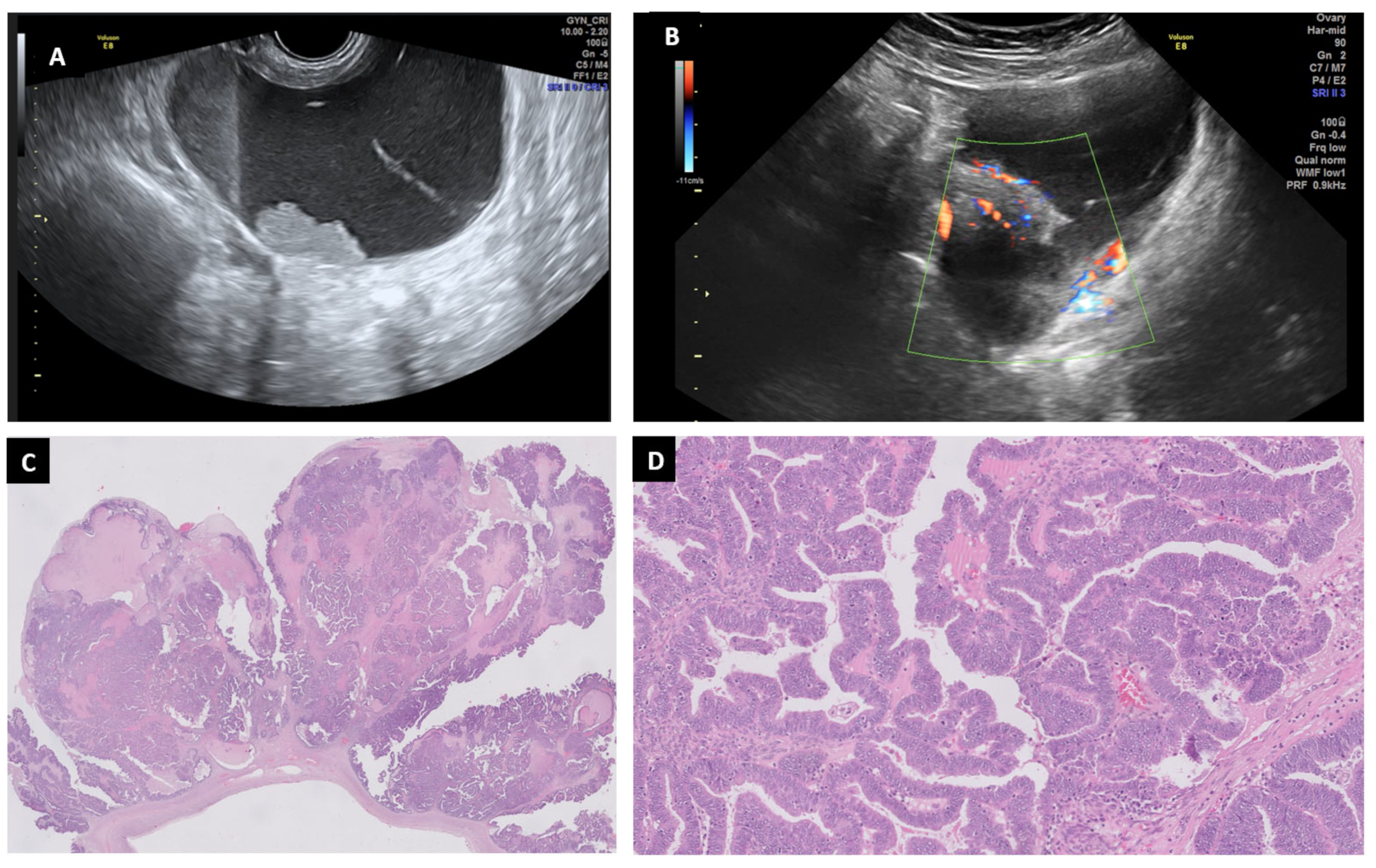 Diagnostics 13 02785 g011