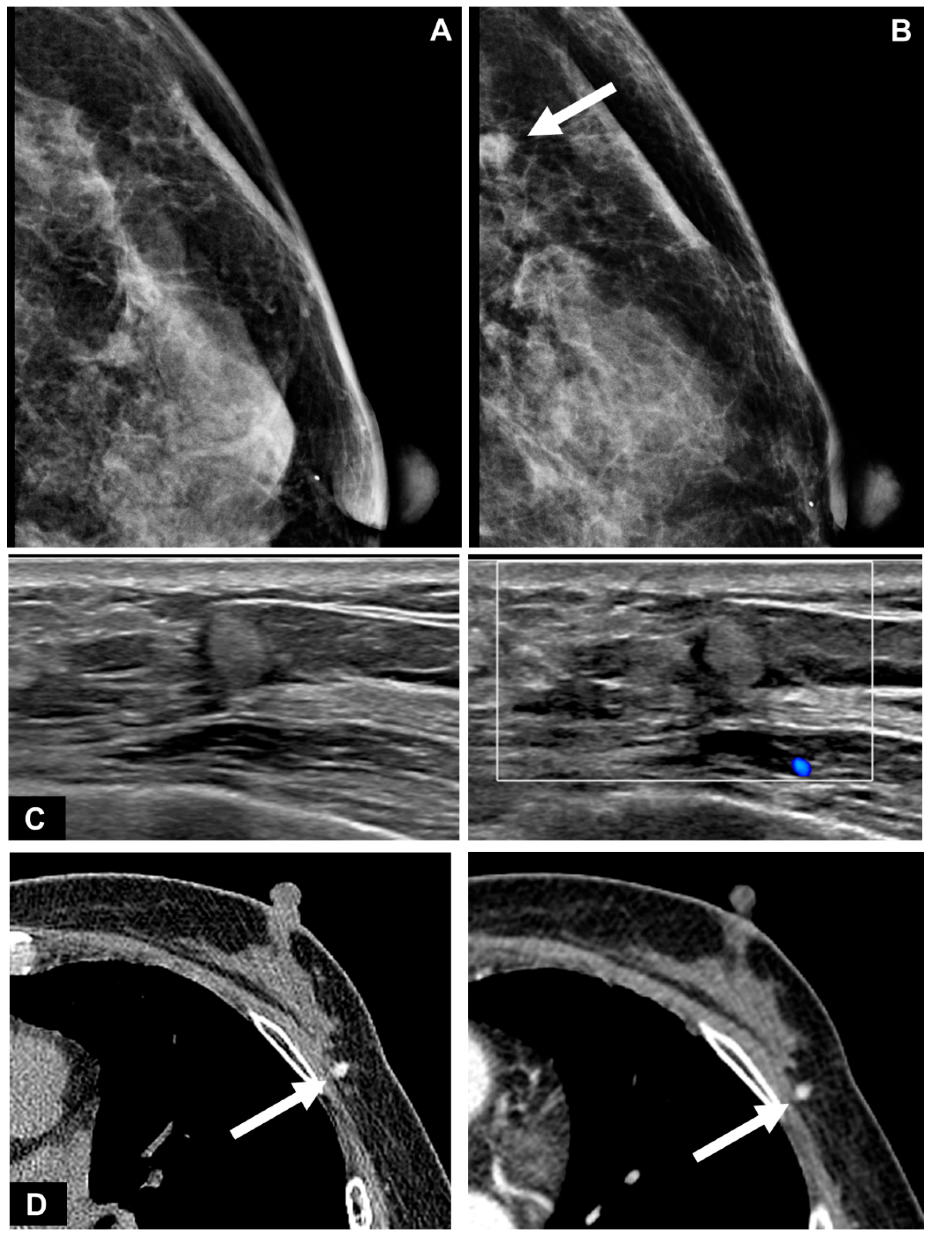 Diagnostics 13 02800 g002