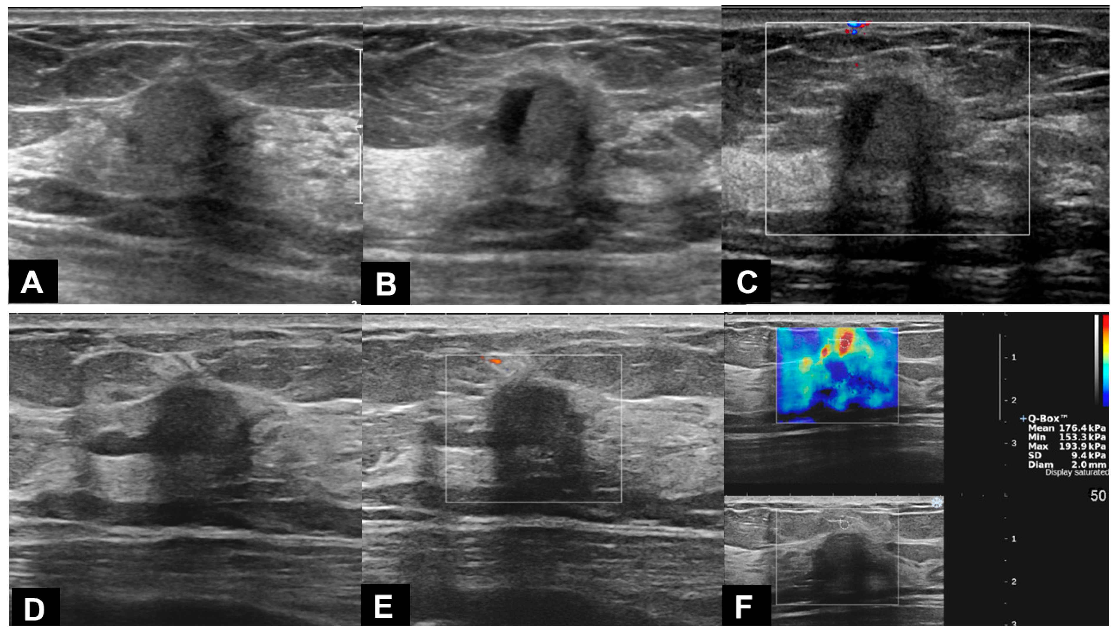 Diagnostics 13 02800 g004