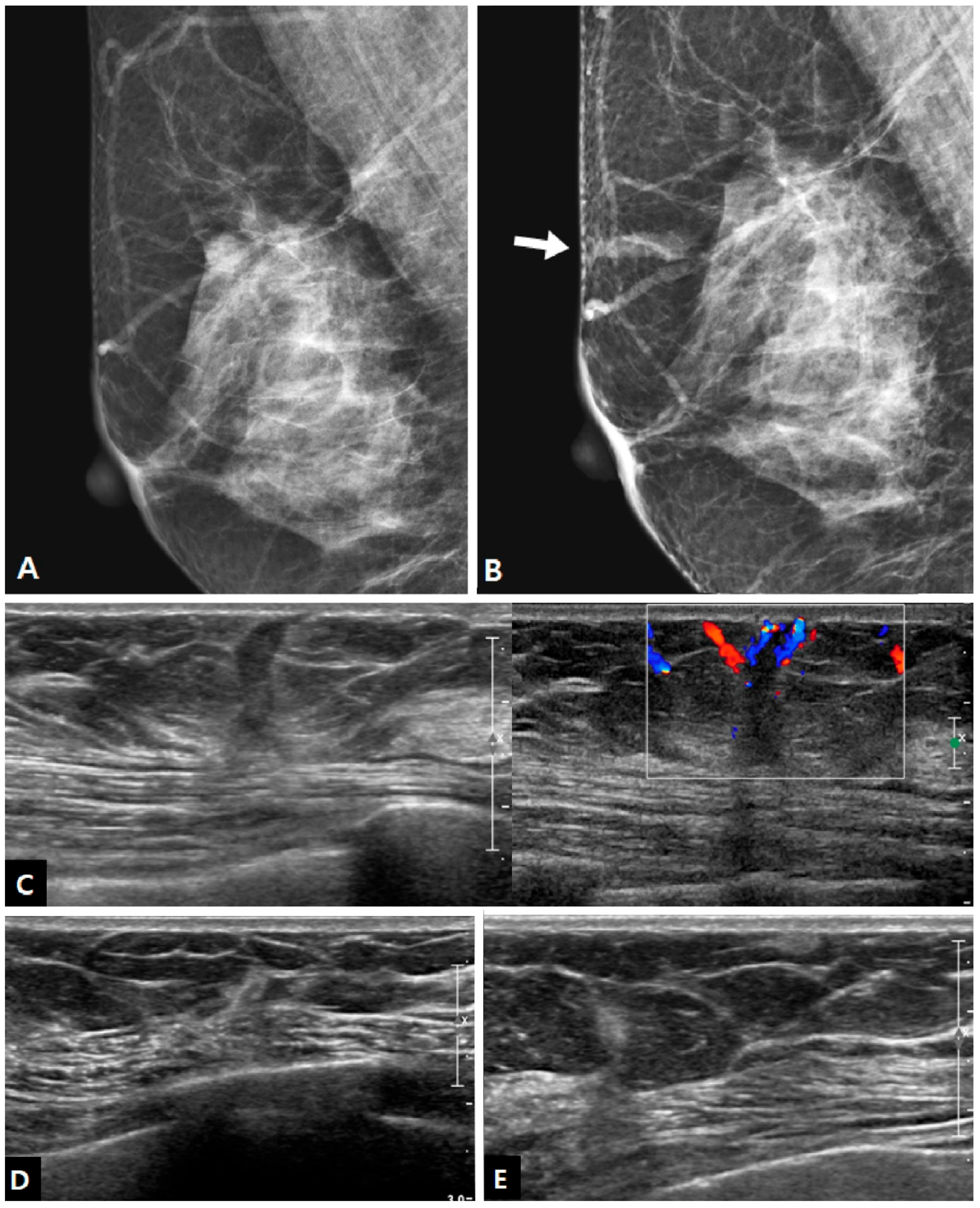 Diagnostics 13 02800 g005