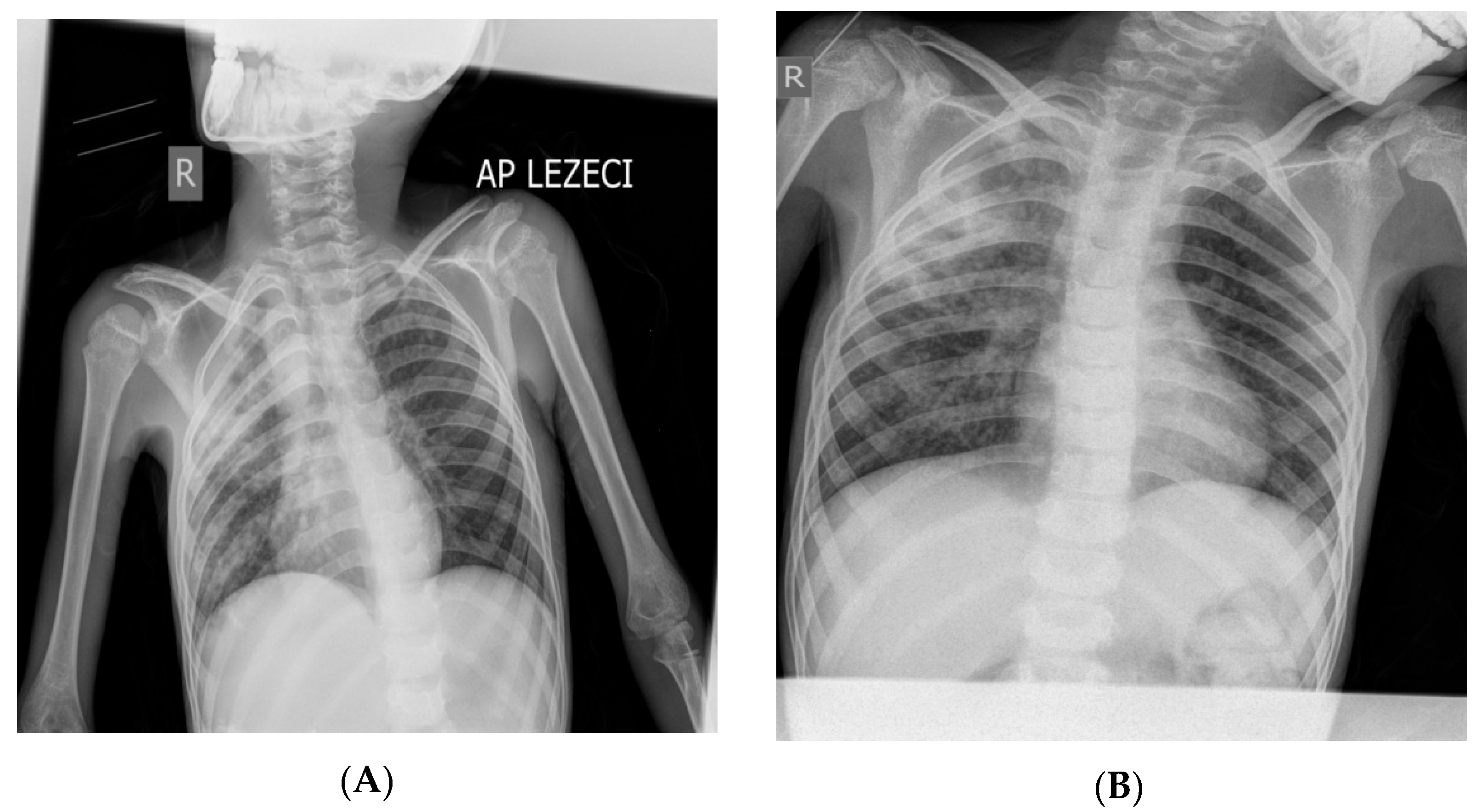 Diagnostics 13 02826 g001 Diagnostics 13 02826 g001