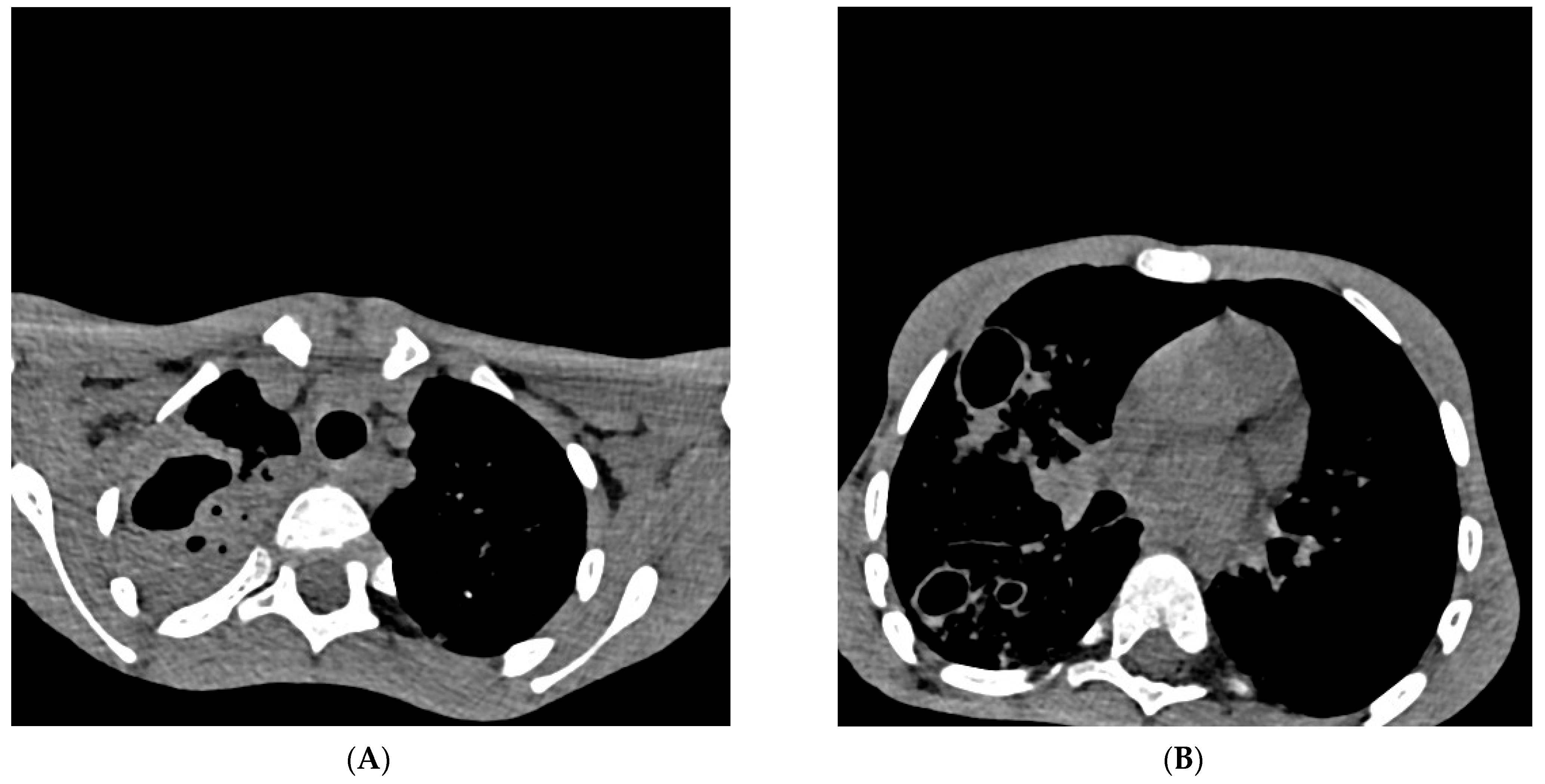 Diagnostics 13 02826 g002 Diagnostics 13 02826 g002