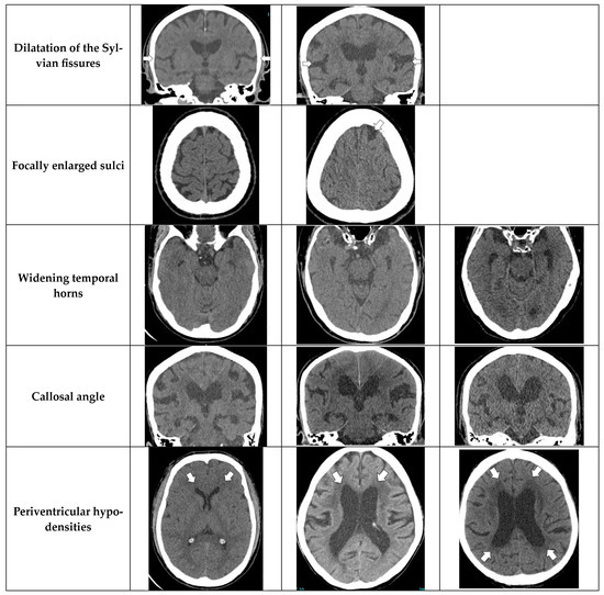 Diagnostics Free FullText The Diagnostic Accuracy of Artificial