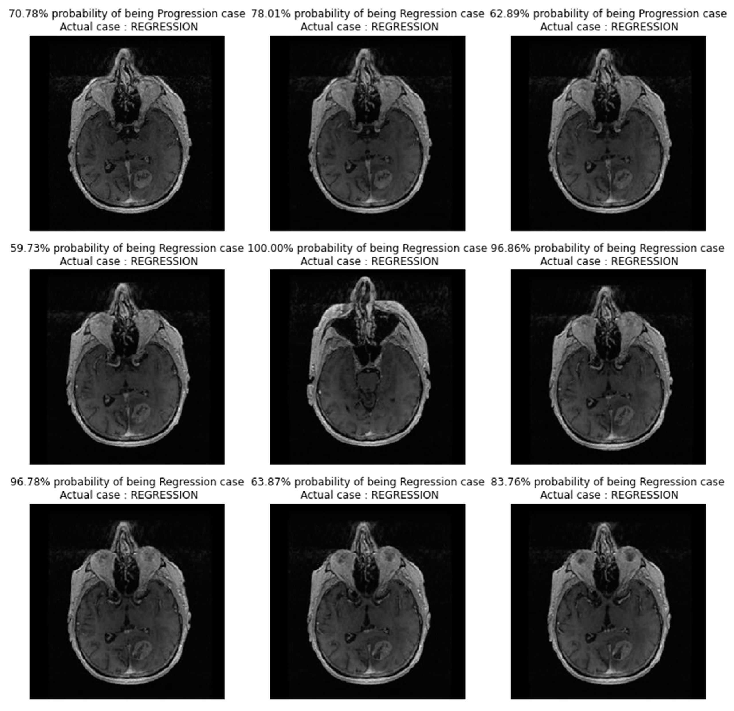 Diagnostics 13 02853 g004