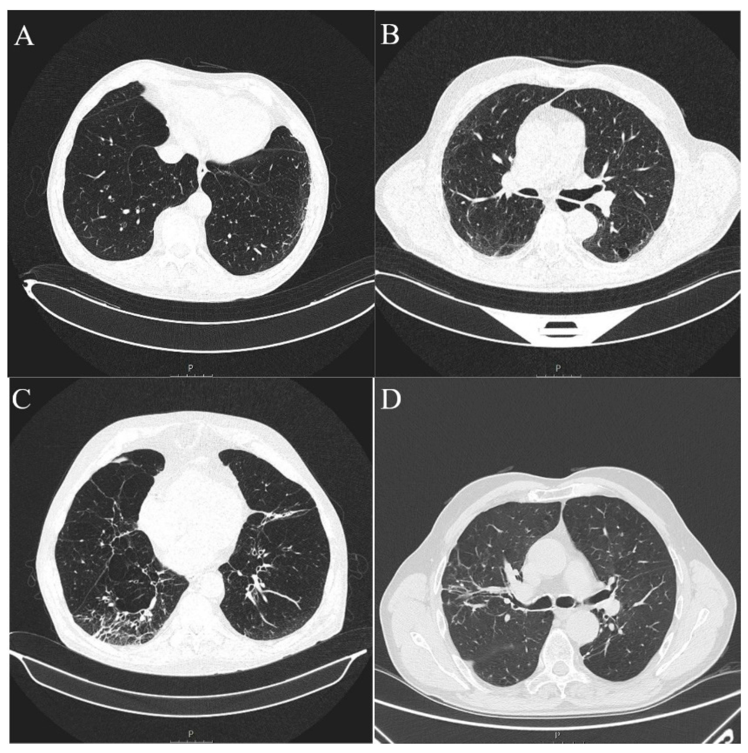 Diagnostics 13 02908 g004