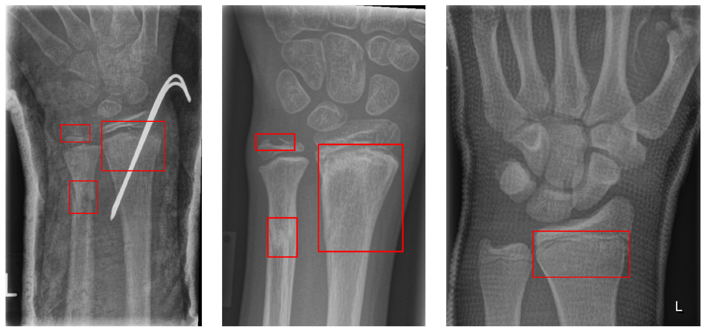 Diagnostics 13 02927 g002